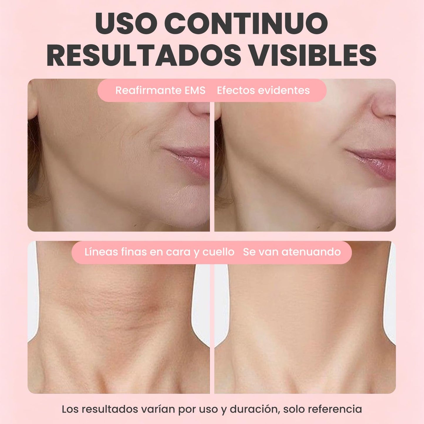 Masajeador Facial de EMS, Rodillo Facial Antiarrugas, 3 Niveles Regulables, para Lifting Facial, Reafirmacion Facial y Reduce la Papada, Apto para Rostro, Cuello, Piernas y Brazos