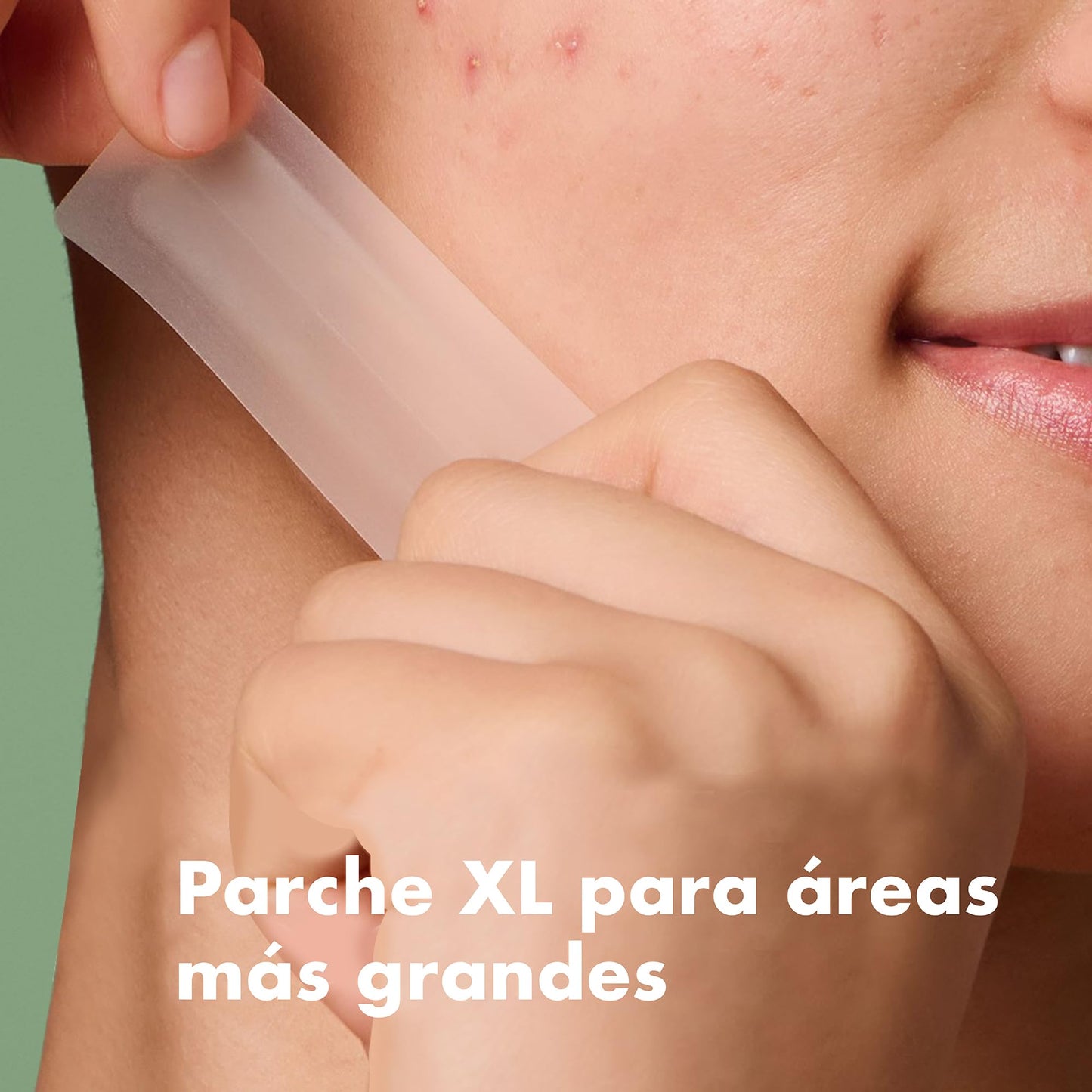 Hero Mighty Patch Surface, 10 Parches XL con Hidrocoloide para el Acné, Uso en Cuerpo, Mejillas, Espalda y Frente