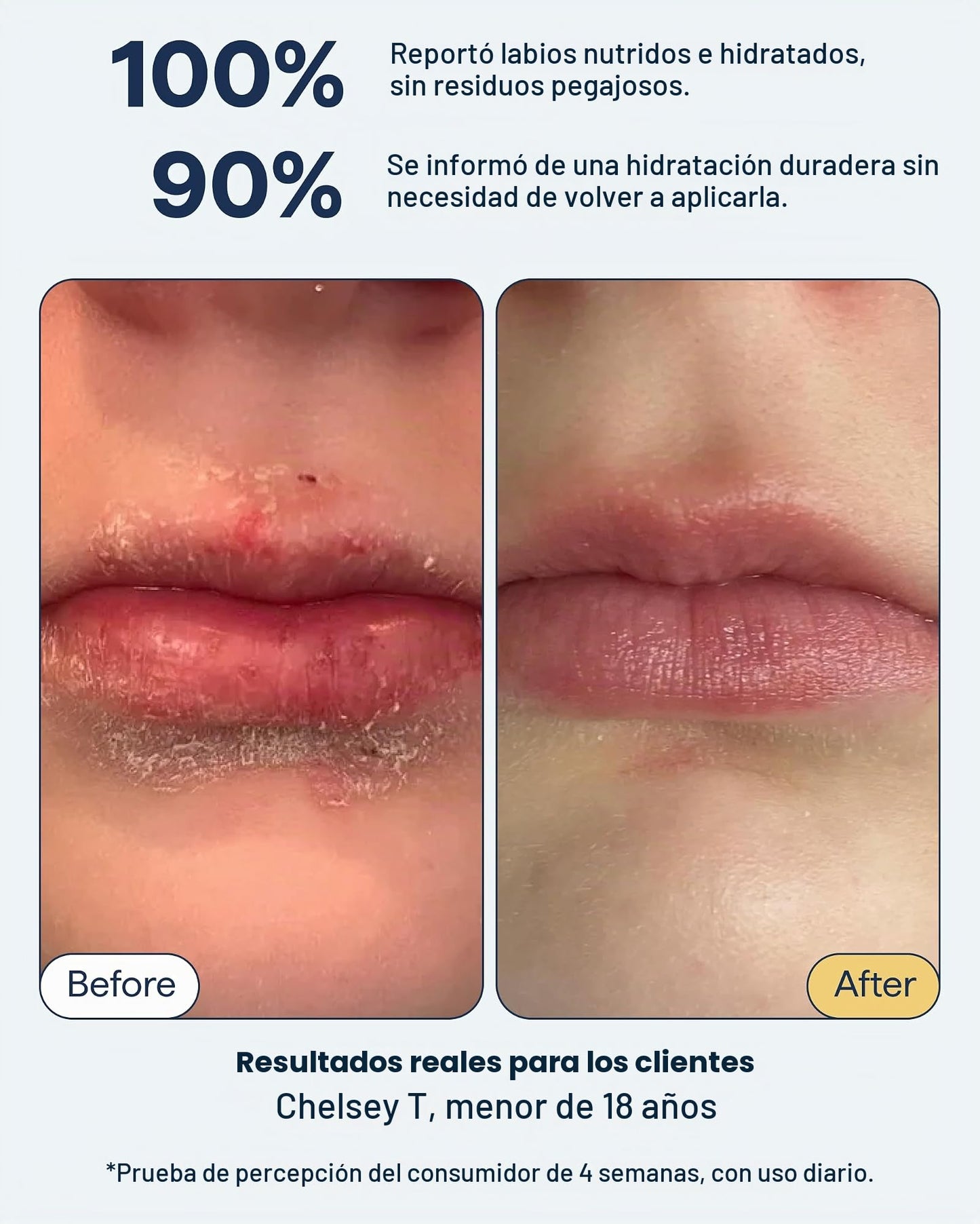 Remedy Science Remedio para los labios secos: bálsamo labial hidratante y cicatrizante con ceramidas, péptidos y dimeticona. Repara los labios secos y agrietados. Por el dermatólogo Dr. Shah
