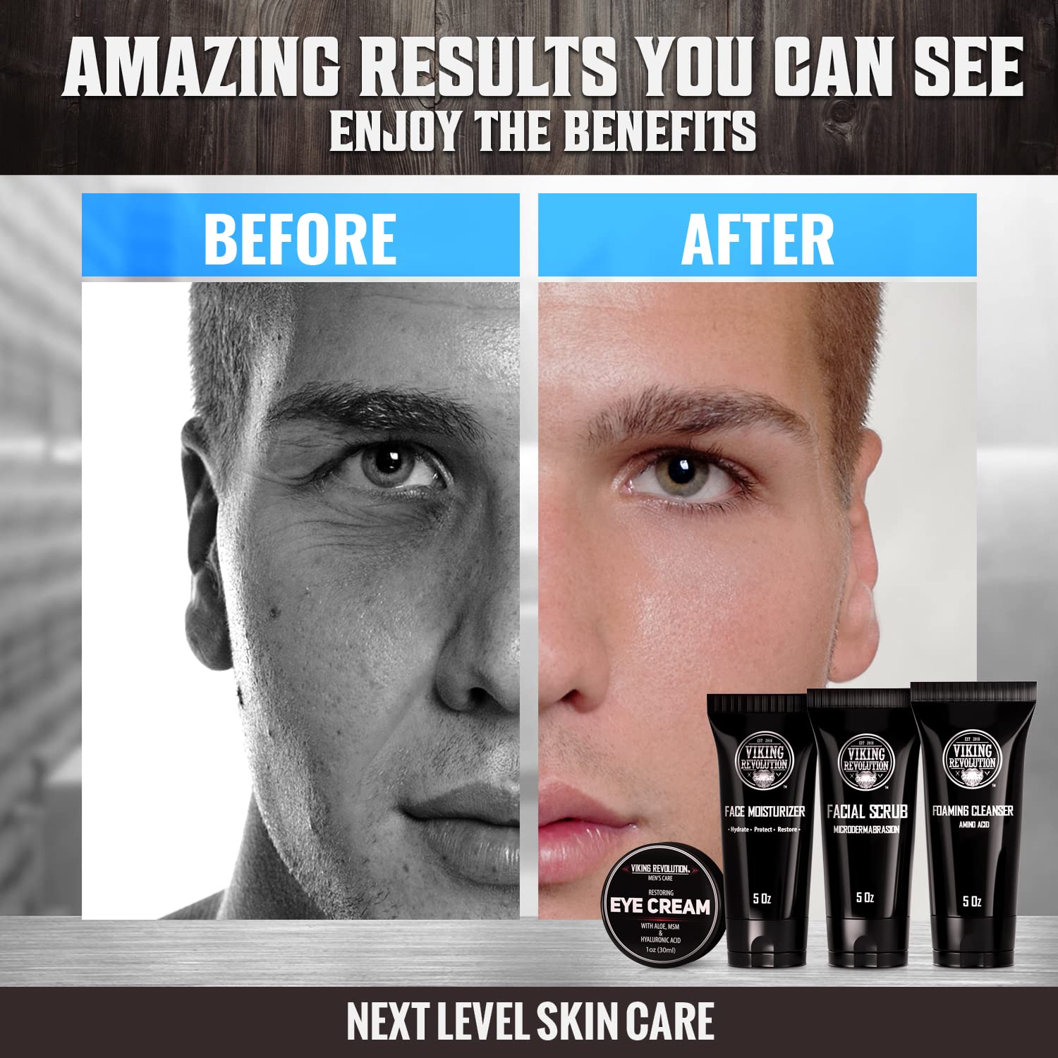 Viking Revolution- Kit de cuidado facial para hombres: incluye humectante facial rejuvenecedor (5 oz) y microdermoabrasión facial