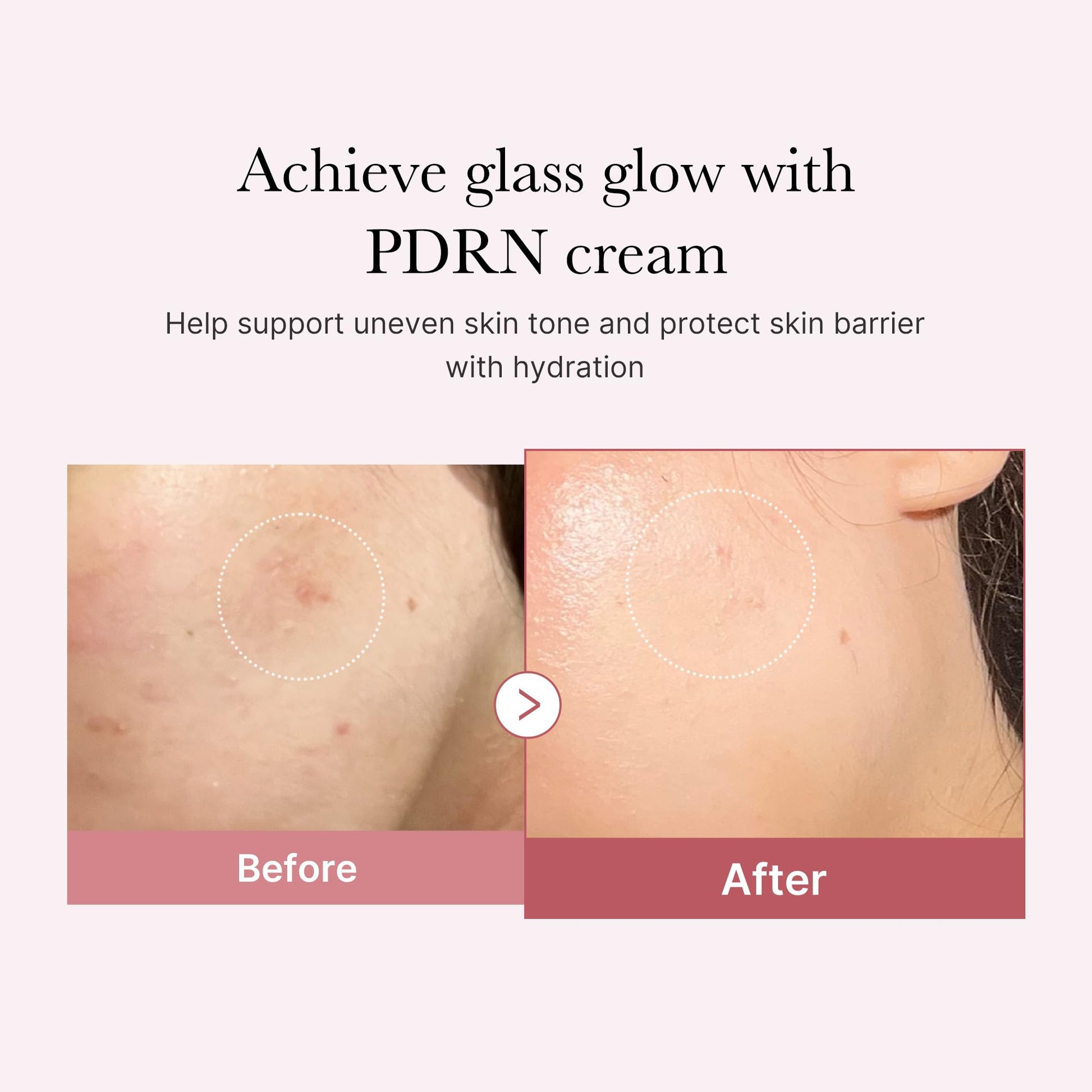 Medicube Salmon DNA PDRN Crema hidratante hialurónica rosa, crema calmante rosa, ácido hialurónico, niacinamida, hidratante y reafirmante, tono de piel desigual, cuidado de los poros, cuidado de la