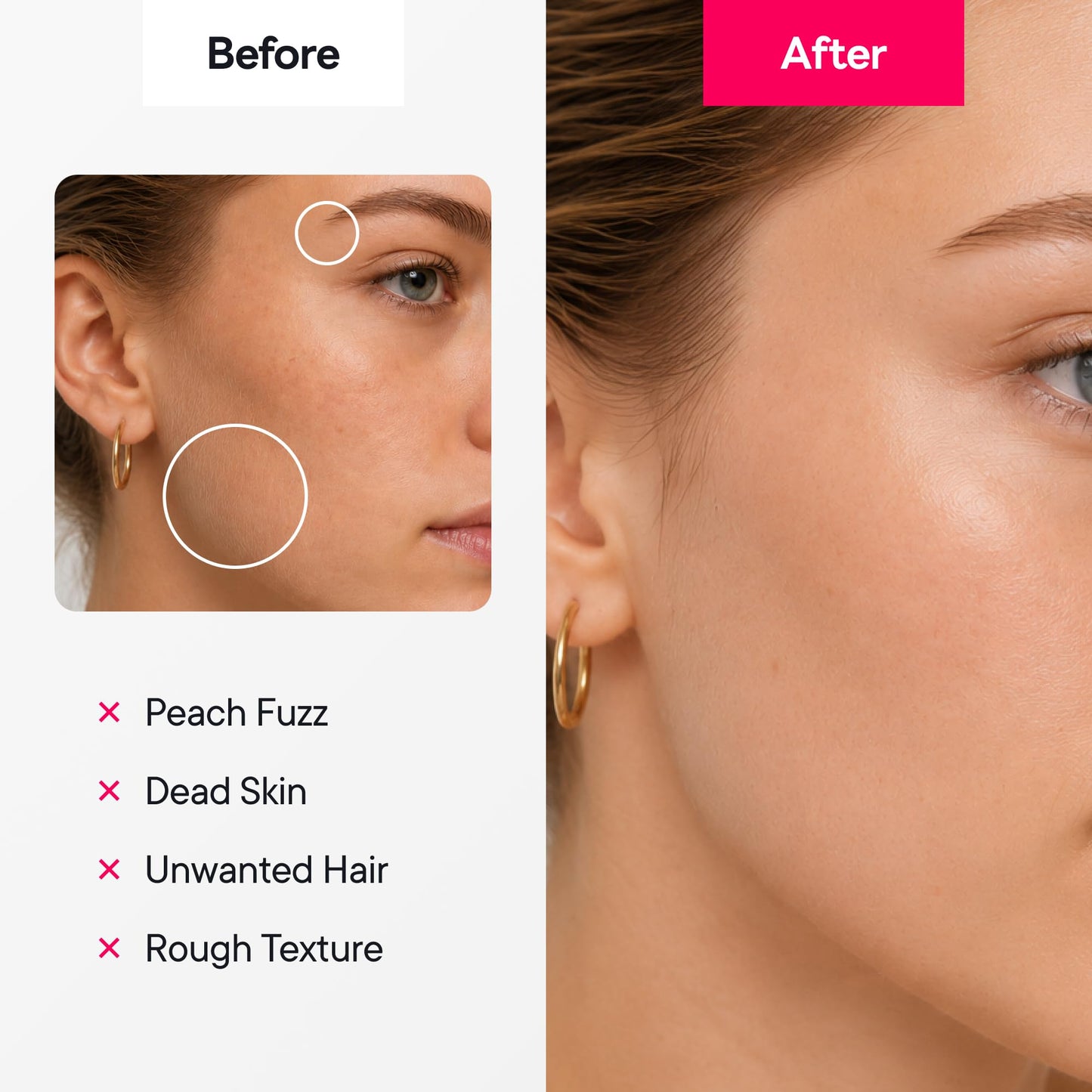 Maquinilla de afeitar Dermaplane para mujeres, herramienta de dermaplaning, maquinillas de afeitar faciales para mujeres y hombres, recortadora de cejas y afeitadora depilatoria facial, cuchillas de