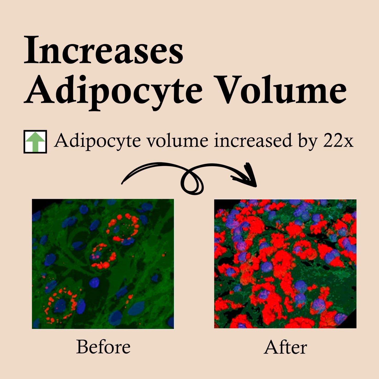 Suero CELDYQUE Volufiline Reafirmante Concentrado