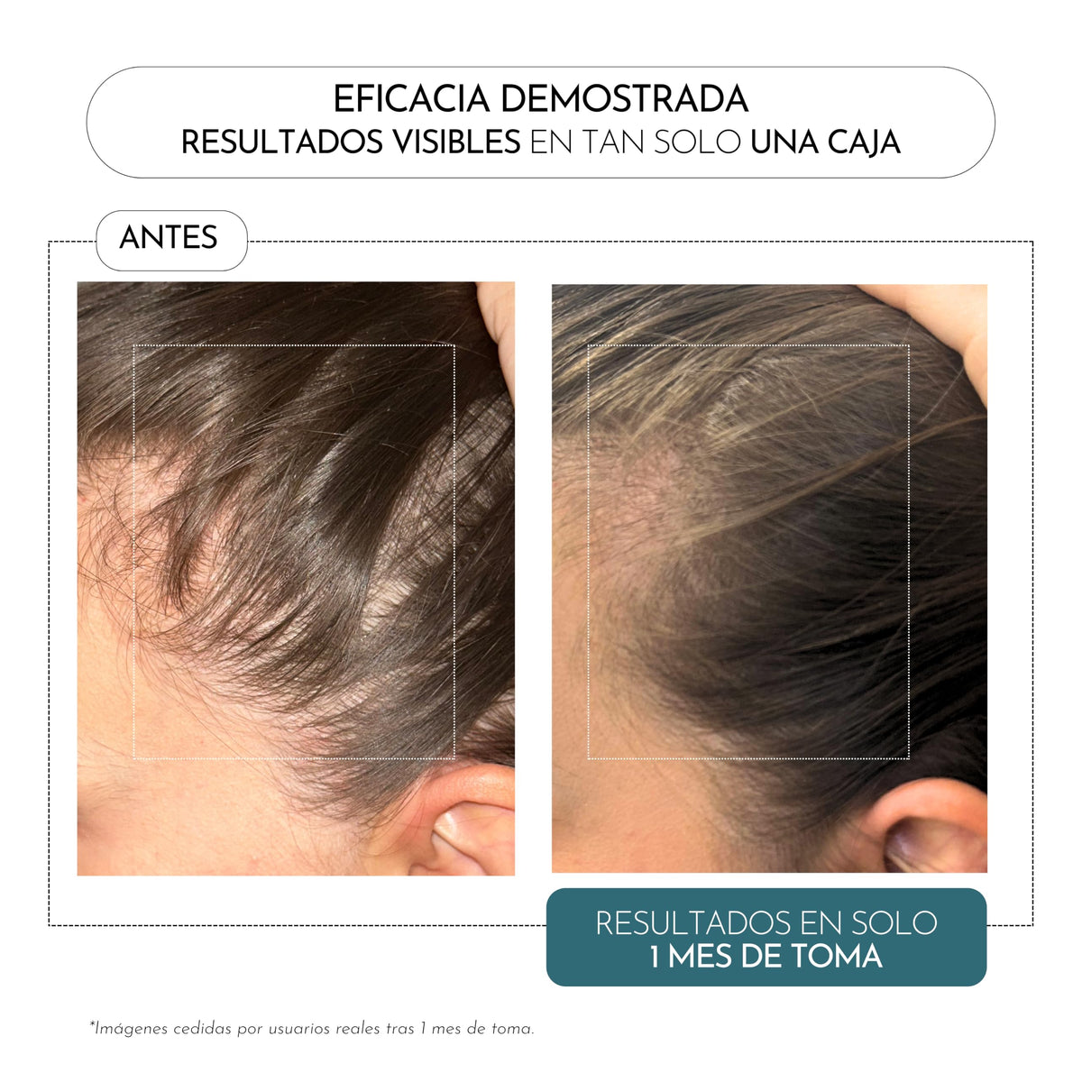 Cápsulas Luxmetique Hair Formula 60 Cápsulas