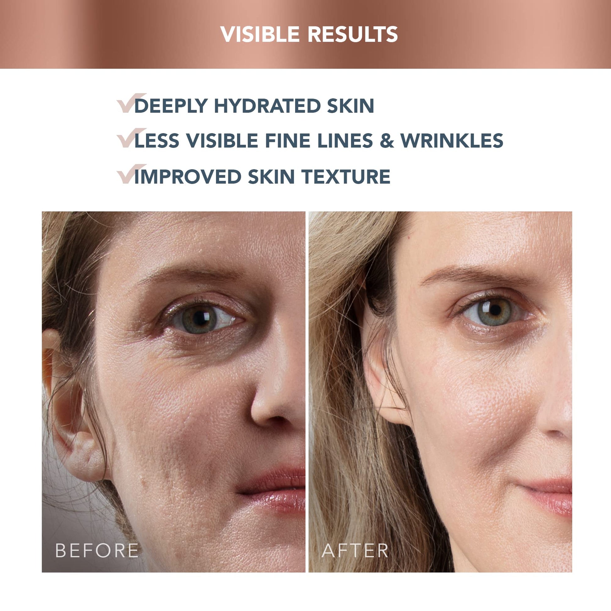 FOREO SUPERCHARGED Crema Hidratante Facial Triple Acción HA+PGA - Contorno de Ojos - Acido Hialuronico - Vitamina E - Vegano - Crema Facial Hombre - Skincare - 50 ml