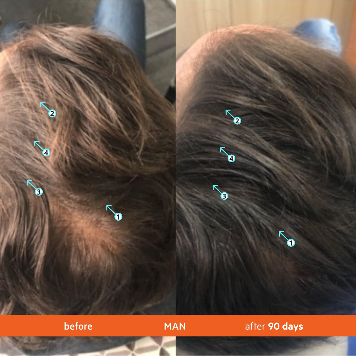 DS Laboratories | Revita® Acondicionador para la Densidad Capilar