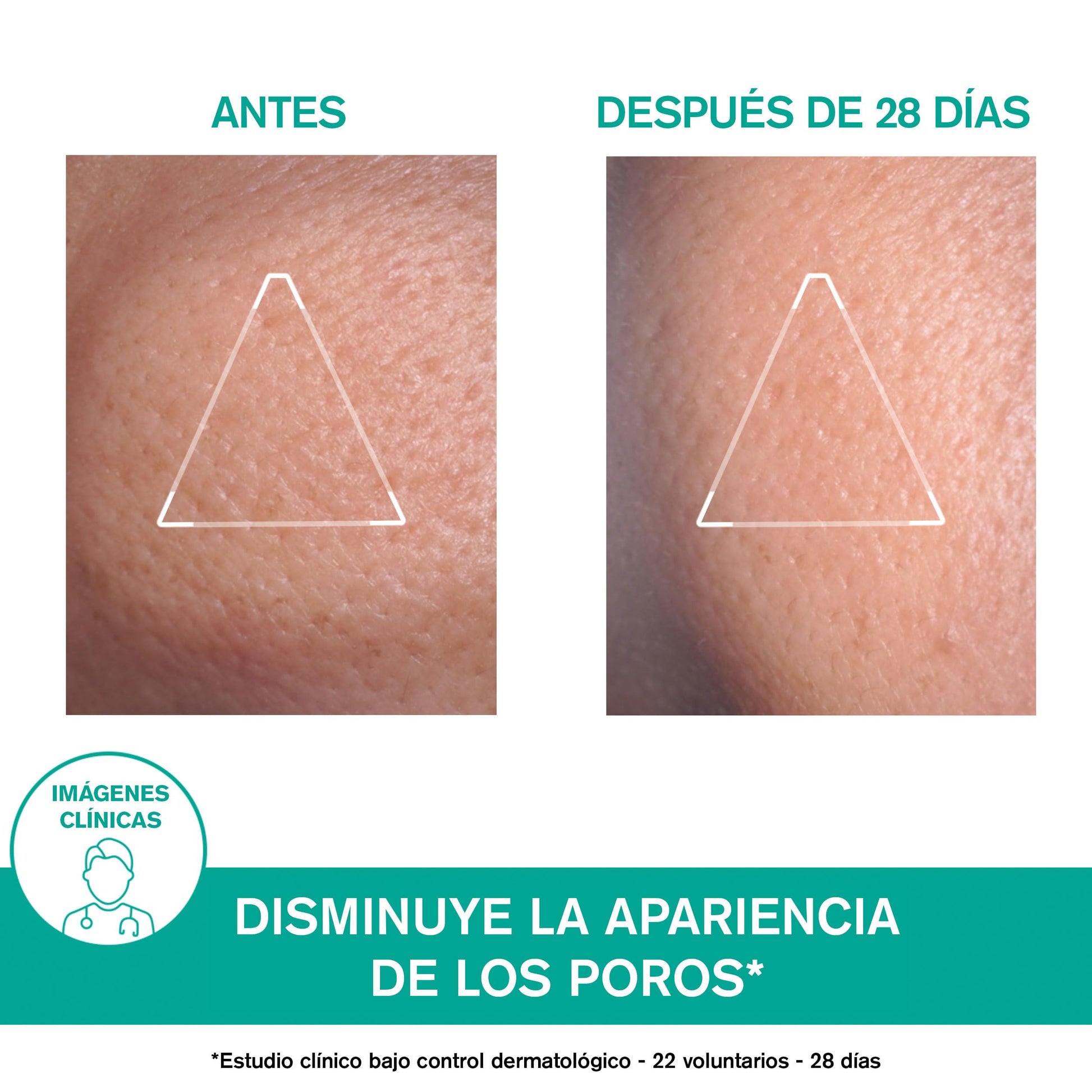 Uriage Hyseac Crema Facial Emulsión Matificante - Emulsión fluida-ligera, con efecto mate-aterciopelado - Para pieles mixtas a grasas - Controla los brillos, disminuye la apariencia de los poros y proporciona una hidratación duradera - No Comedogénico