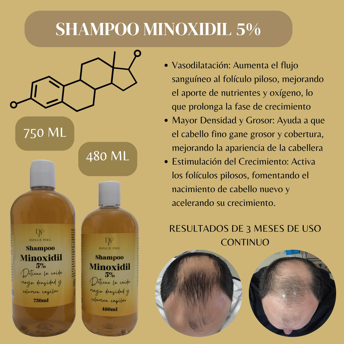 Champú Dolce Piel Minoxidil 5% Estimulante Crecimiento y Densidad Cabello sin Sulfatos ni Parabenos para Alopecia Androgenética