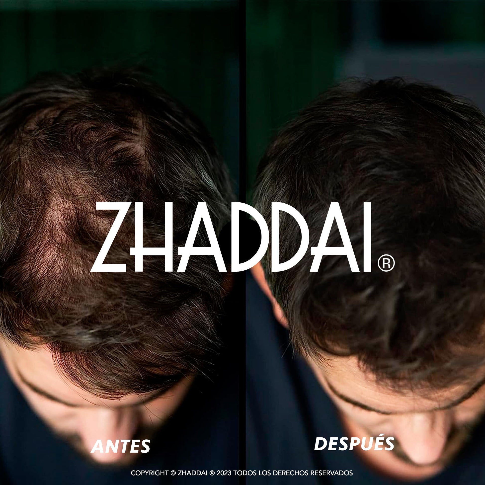 Fibras Capilares ZHADDAI® - 100% Natural. Cubre calvicie, disimula alopecia y densifica cabello. Aporta volumen y textura. ¡Voluminizador Instantáneo!