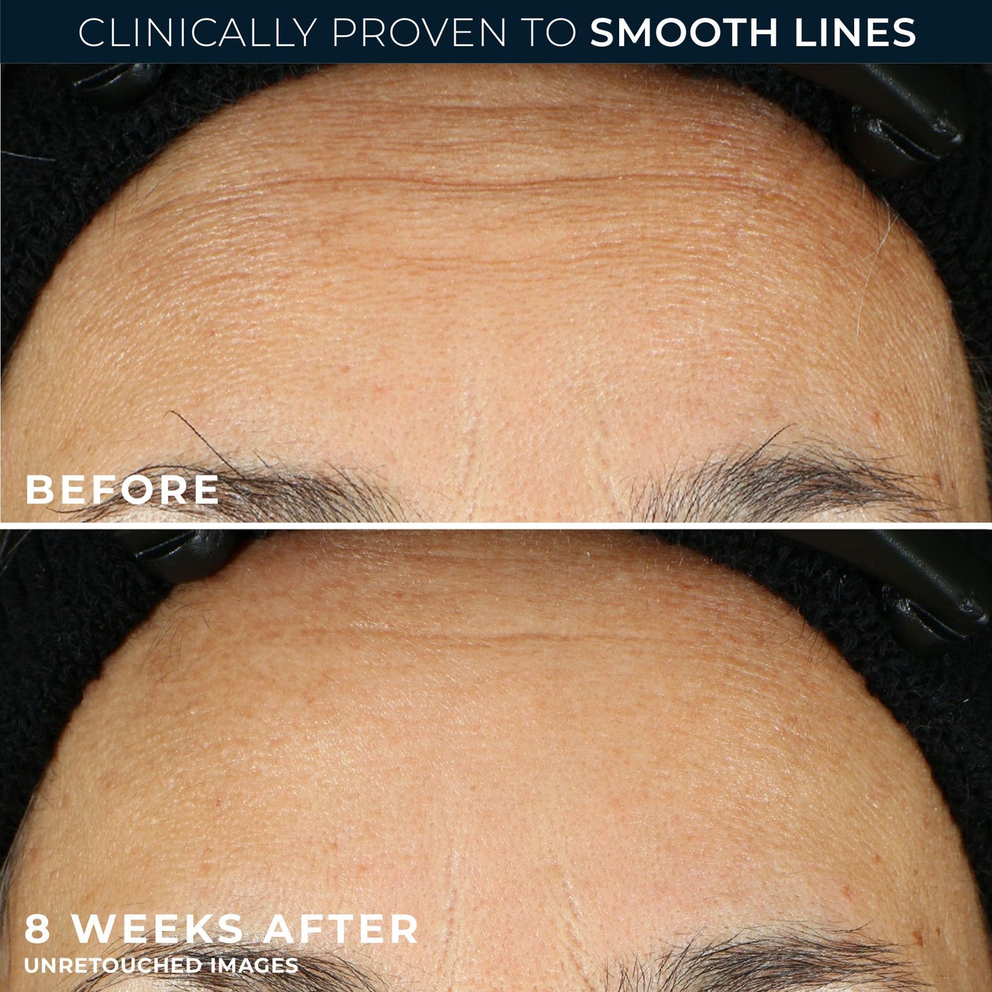 RoC Retinol Correxion Line Smoothing Night Retinol Serum, 30 Capsules
