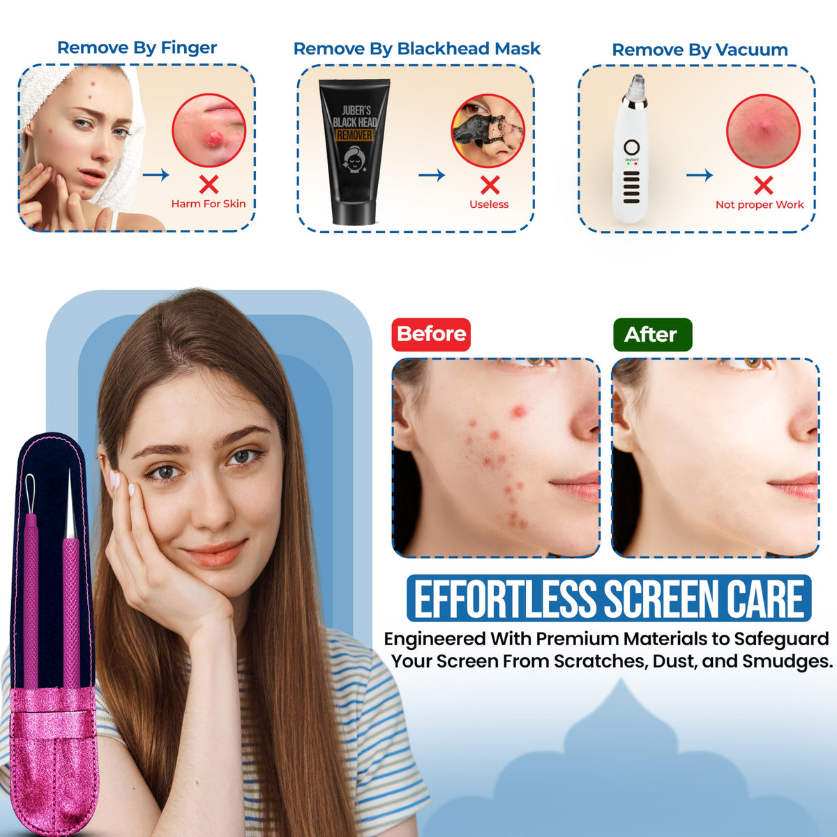 EFAH Care Extractor de espinillas de acero inoxidable para tratamiento del acné, manchas quirúrgicas, eliminador de puntos negros, perfecto para la cara y la nariz, fácil de limpiar, color rosa