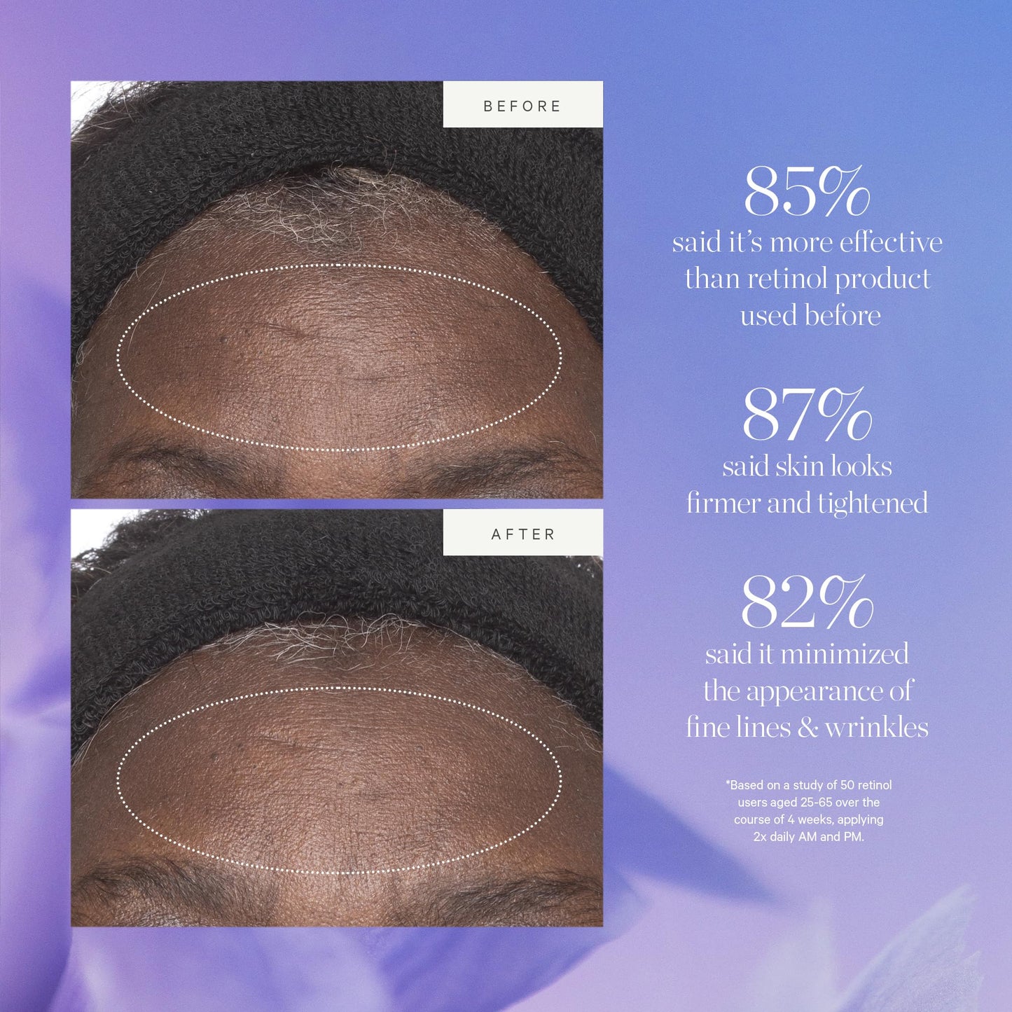 KORA Organics- Hidratante alternativo a retinol con células madre vegetales, mezcla activa de retinol alternativo que suaviza las arrugas