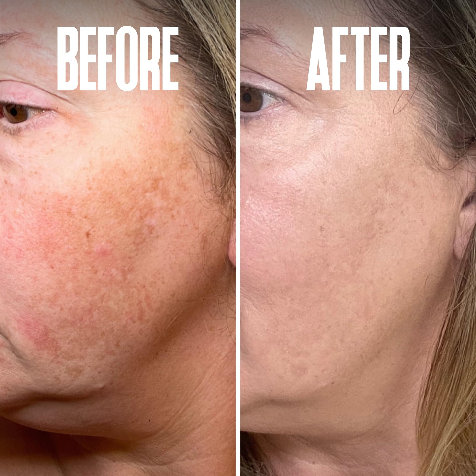 Divine Derriere Skin Lightening 2% Hydroquinone Dark Spot Corrector For Face & Melasma Treatment Fade Cream - Contains Vitamin C, Salicylic Acid, Kojic Acid, Azelaic Acid and Lactic Acid 1.0 oz / 30ml