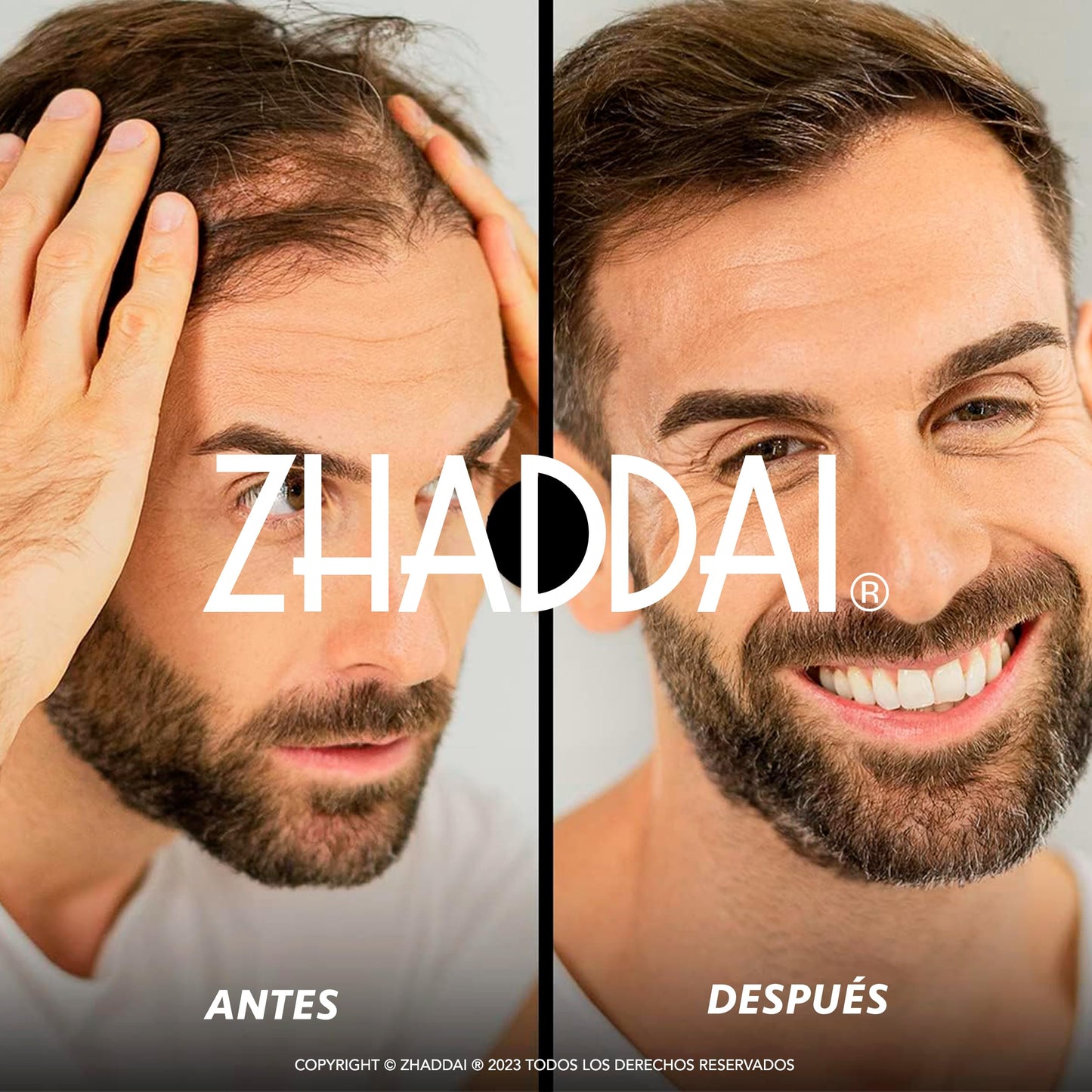 Fibras Capilares ZHADDAI® - 100% Natural. Cubre calvicie, disimula alopecia y densifica cabello. Aporta volumen y textura. ¡Voluminizador Instantáneo!