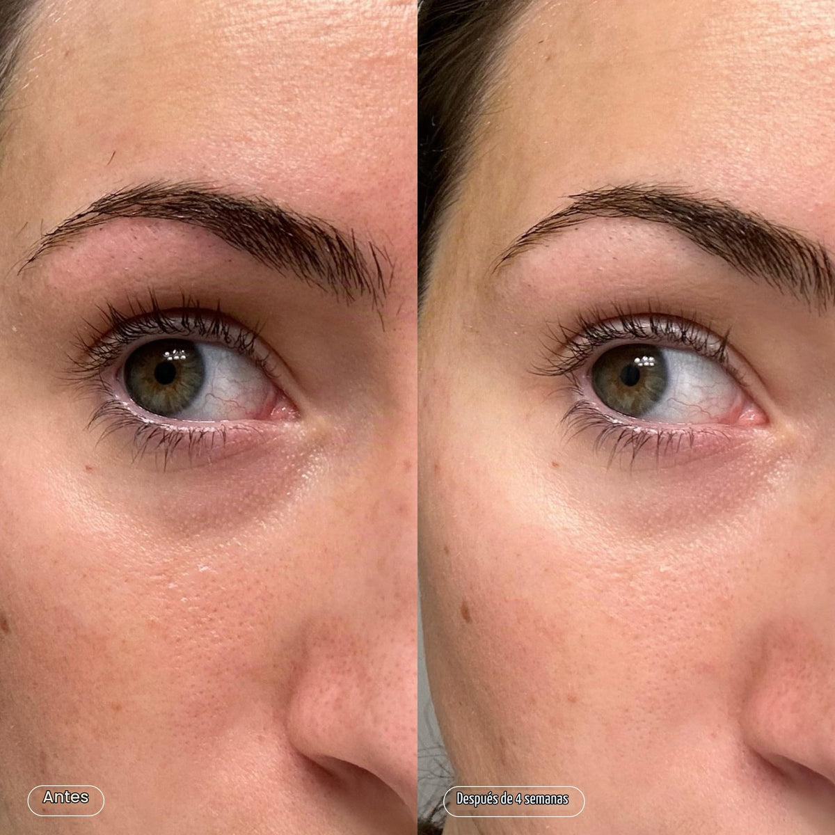 Topicals Máscaras de brilho desbotado para os olhos | Remendos para depuff, hidratar, iluminar e esfriar | Reduz olheiras e linhas finas | Contém ácido kójico, cafeína e niacinamida (conjunto com 6)