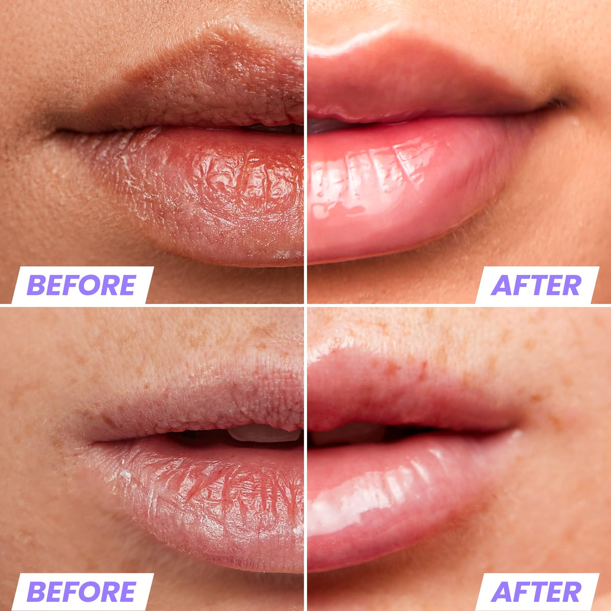 Wonderskin Lip Oil - Aceite De Suero De Rehabilitación De Labios, Suero Transparente Hidratante E Hidratante Para Labios Secos - Natural, Vegano Y No Pegajoso (Transparente)