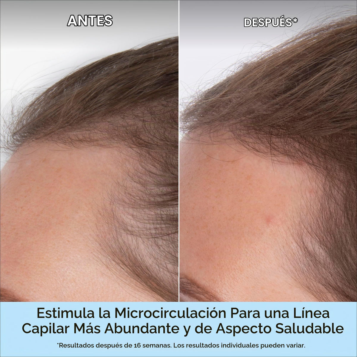 Suero Capilar Briogeo MegaStrength Plus Cafeína y Biotina para Unisex