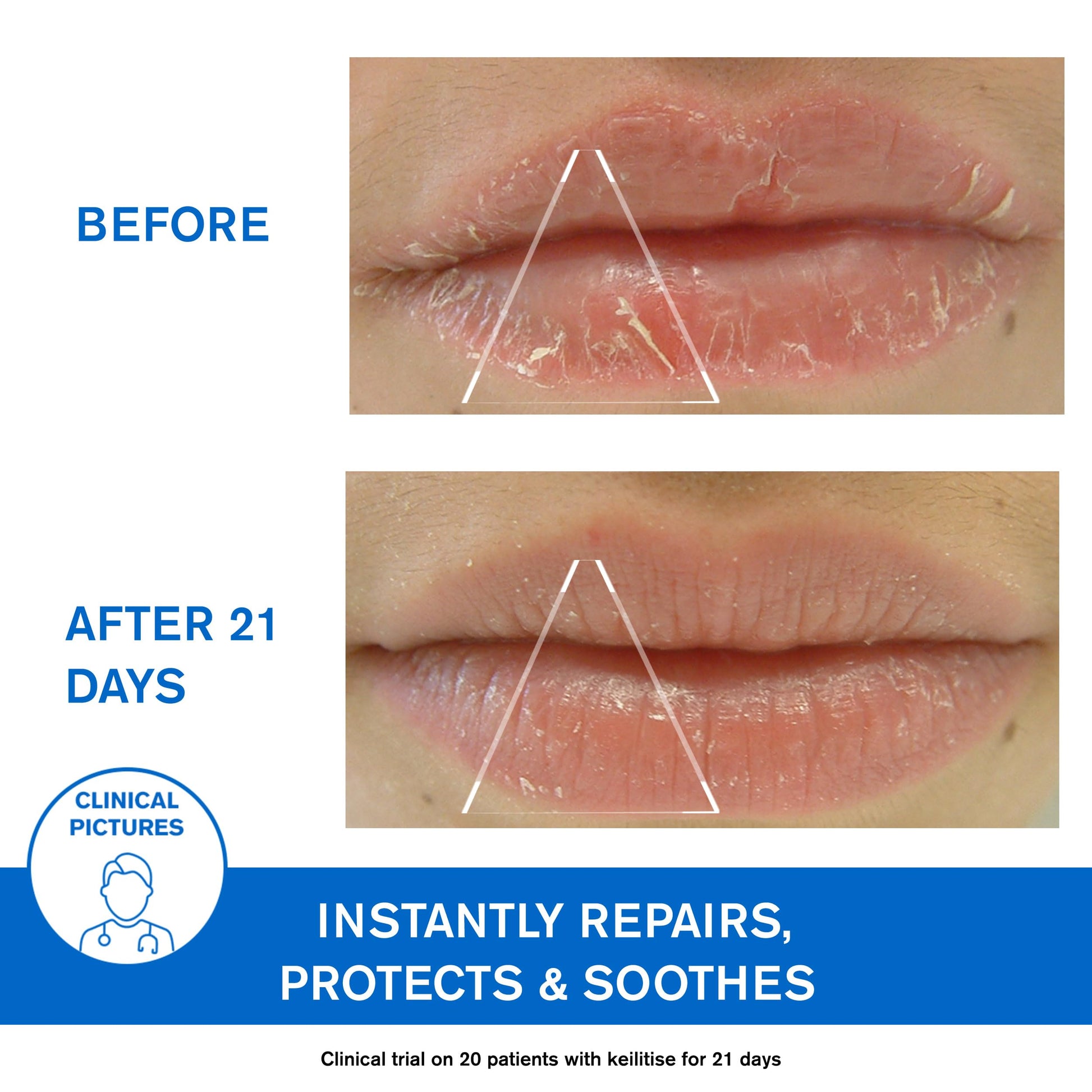 Uriage Bariéderm Cica-Levres 15ml