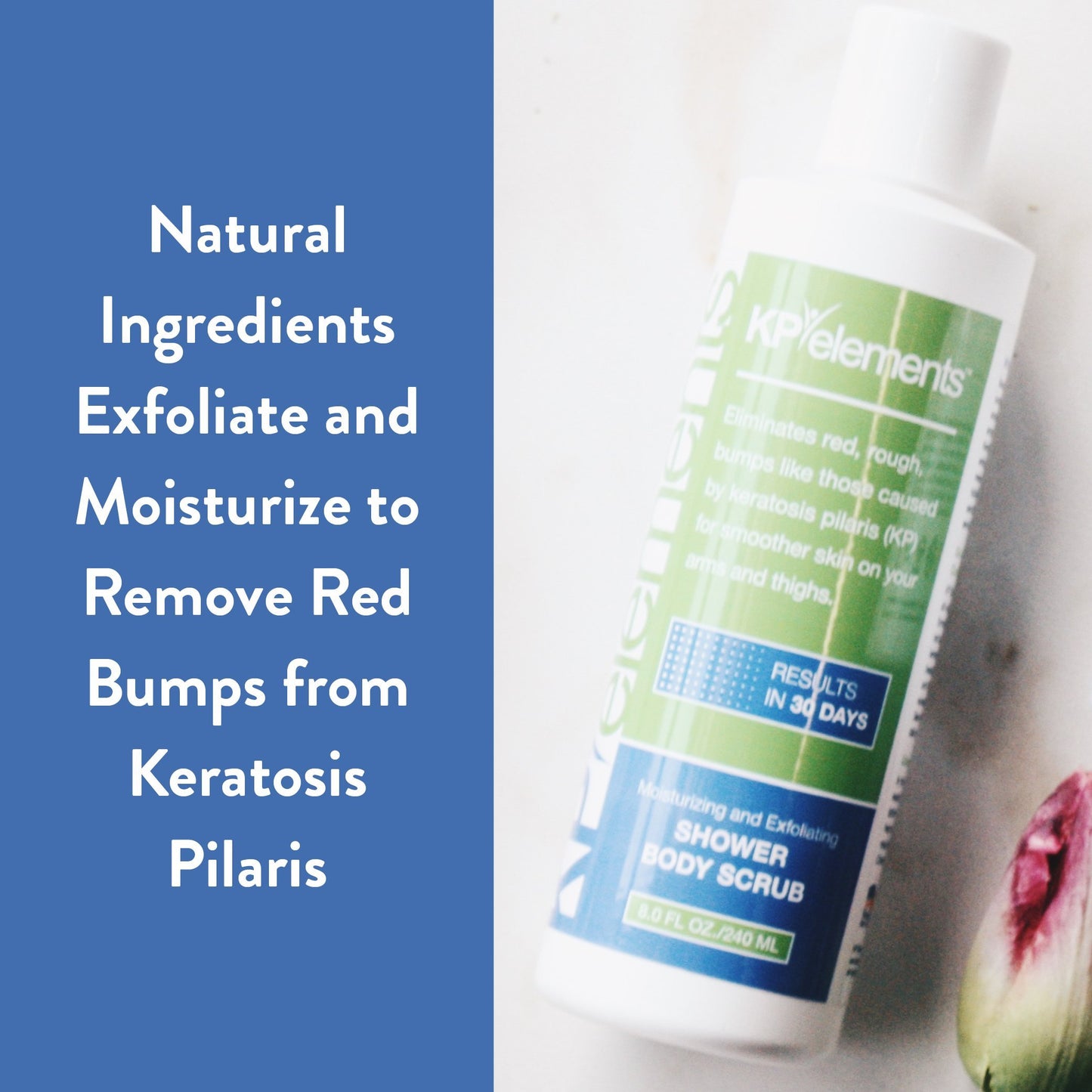 KP Elements Body Scrub - Keratosis Pilaris Treatment - Clear up Red Bumps on Your Arms and Thighs by combining this KP Scrub with Our KP Treatment Cream (1)