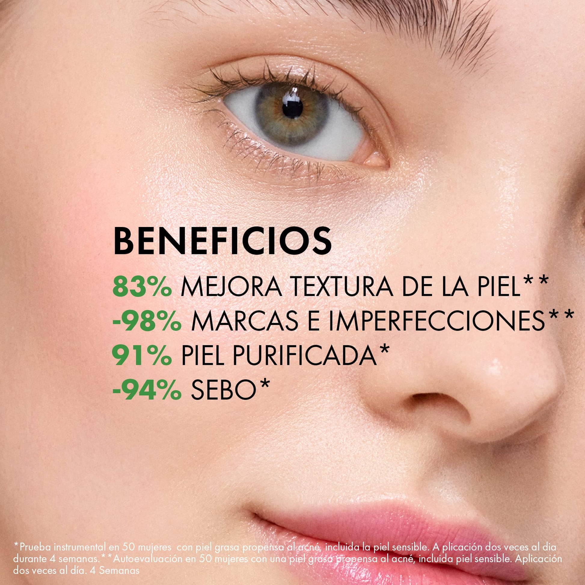 Vichy Gel Limpieza Rostro Anti-imperfecciones Normaderm Phytosolution - Reduce brillo e imperfecciones, para piel rasa o propensa al acné