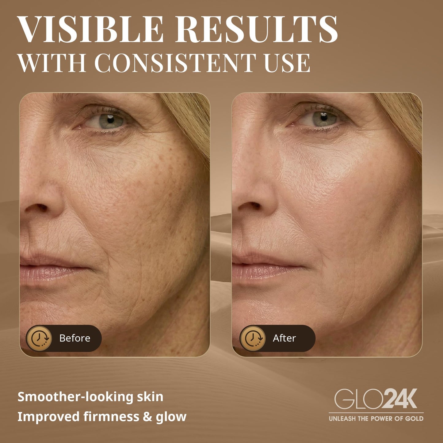 GLO24K - Dispositivo de belleza para rejuvenecimiento de la piel, basado en LED de triple acción, térmica, tecnologías de vibración. Tratamiento antiedad SPA en casa.