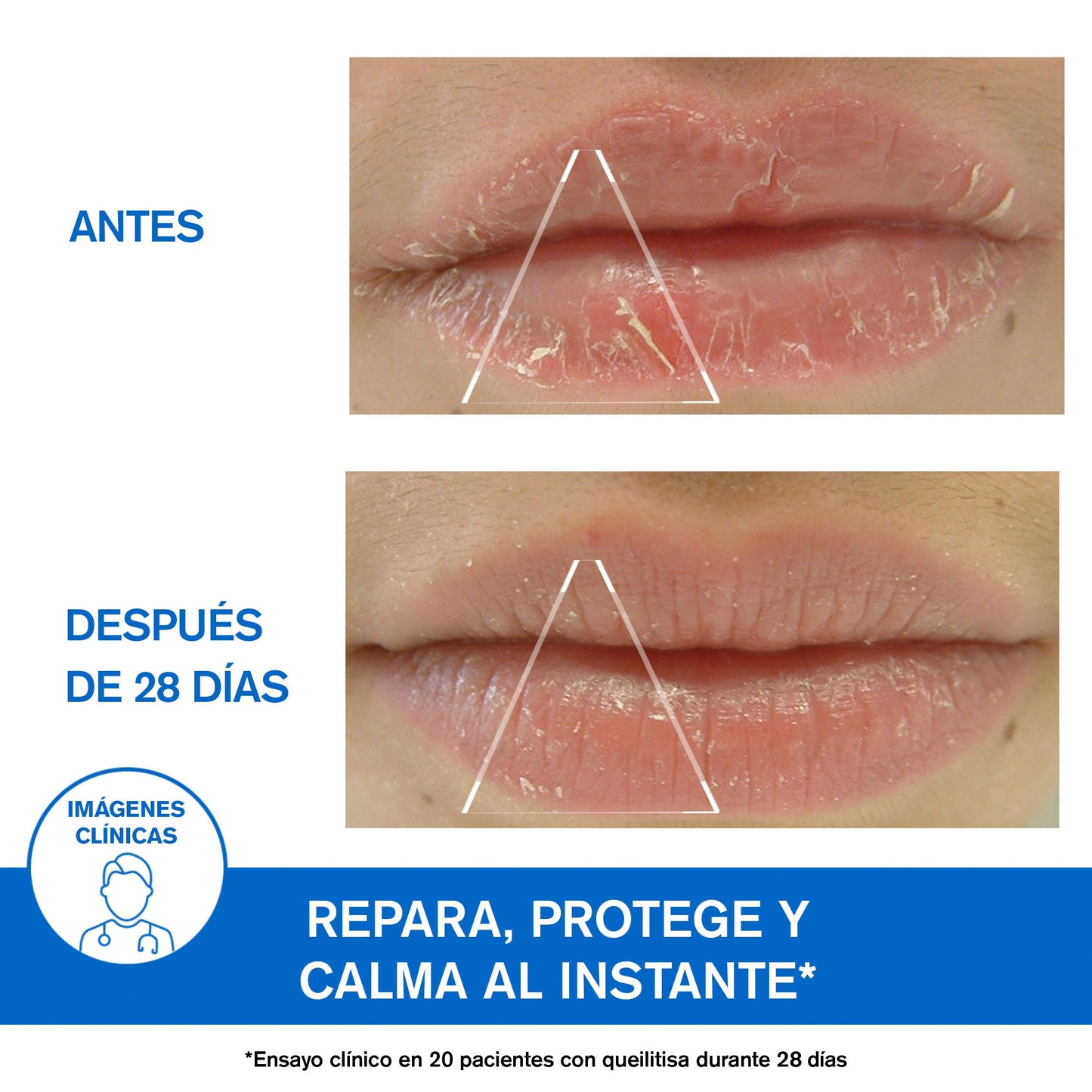 Uriage Bariéderm-Cica Labios Bálsamo Protector con Glicerina - Repara, protege y calma instantáneamente los labios muy secos, agrietados y dañados. Bálsamo labial reparador extra rico para un confort duradero - Sin Perfume