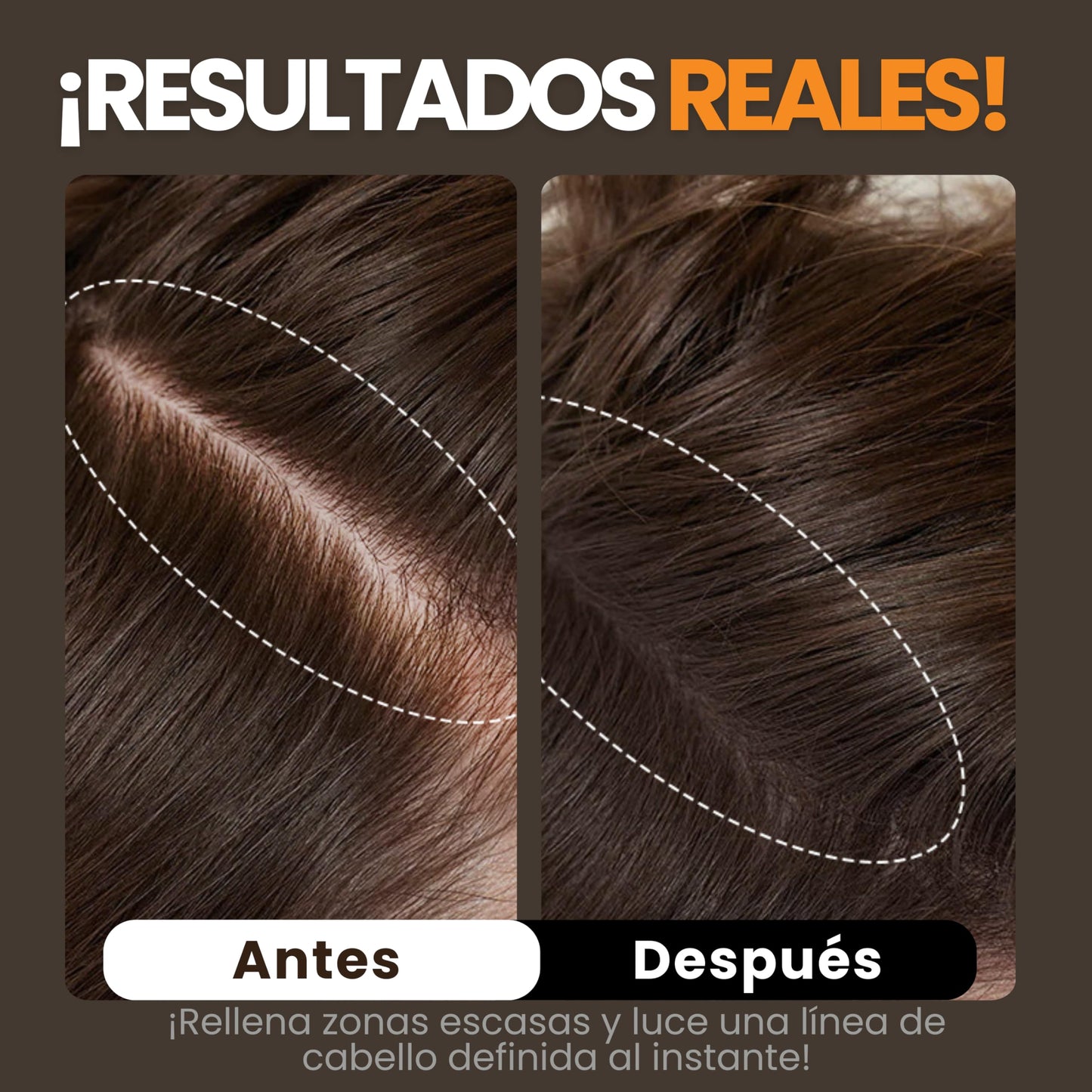 Henrys Polvo para Retocar Raíces Castaño Oscuro, Rellena Zonas Escasas, Define la Línea del Cabello y Cubre el Crecimiento de Raíces al Instante y en Cualquier Momento, Fibras Capilares Hairline Powder. Calvicie, Caida de Cabello o falta de Volumen para M