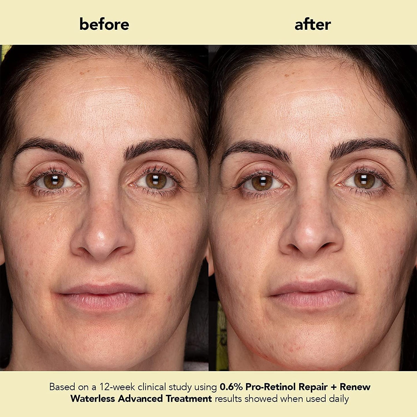 boscia Pro-Retinol Reparación + Renew Tratamiento Avanzado Sin Agua. Suero Libre de Crueldad. Anti-Arrugas, Antienvejecimiento. Vitamina C para Hiperpigmentación 1 fl oz