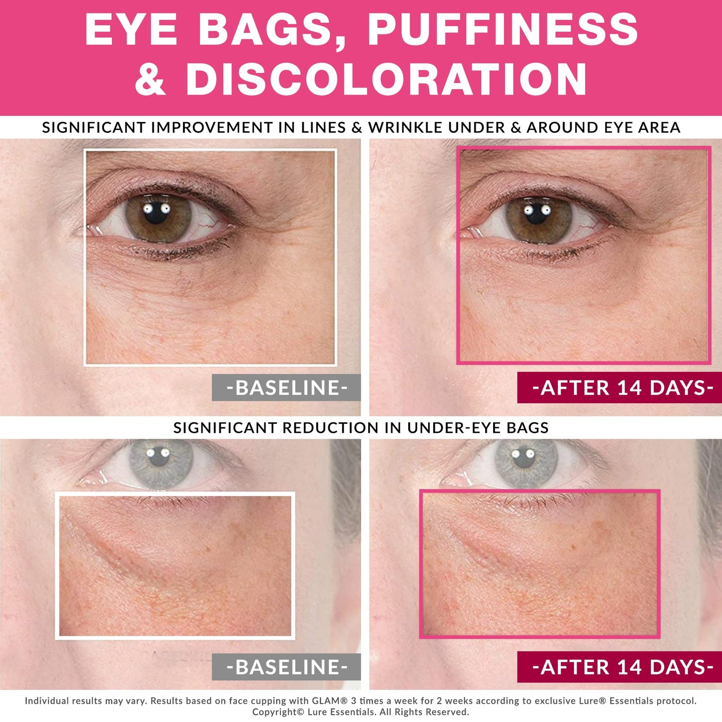 LURE Home Spa Glam Face and Eye Cupping Massage Set with Free Cleansing Brush for Instantly Ageless Look Natural Anti Aging Solution Reduces Fine Lines & Deep Wrinkles, Improves Collagen