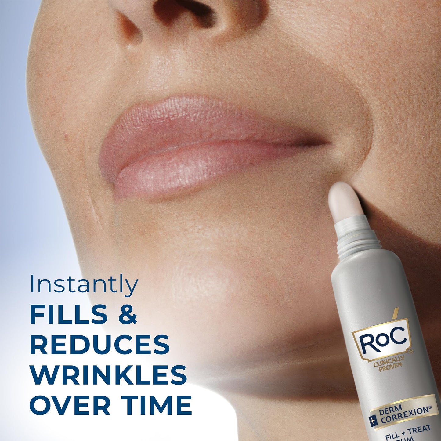 RoC Derm Correxion Fill + Treat Advanced Retinol Serum, Wrinkle Filler Treatment with Hyaluronic Acid for Forehead Wrinkles, Crow's Feet, Eleven Wrinkles, and Laugh Lines, 15ml