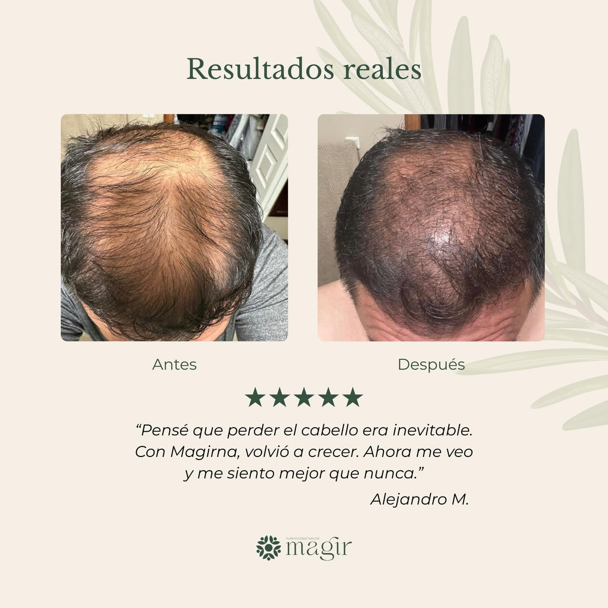 Shampoo Anticaída Magirna con Minoxidil y Biotina, Fortalece y Engrosa el Cabello, Fórmula Intensiva sin Sulfatos ni Parabenos