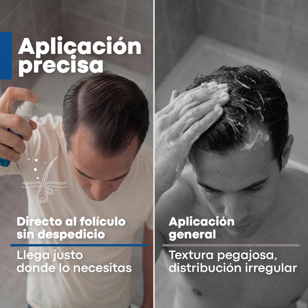 Spray Anticaída Anacastel Minoxidil 5% 60 ml