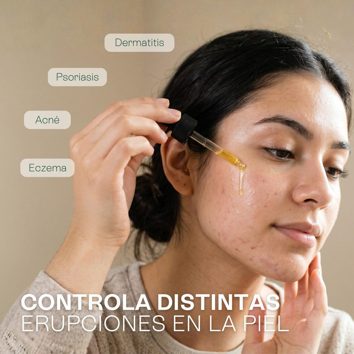 Lúdika | Aceite de Caléndula 50 ml | Calma Piel Sensible y Reactiva | Cicatrizante Antiinflamatorio | Antiacné Antioxidante | para Rostro Cuerpo Cabello y Masaje