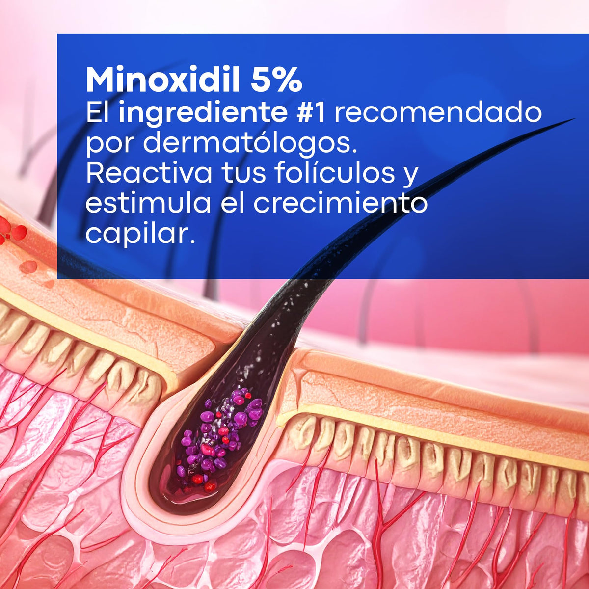 Kit Anticaída Anacastel Minoxidil 5% + Shampoo
