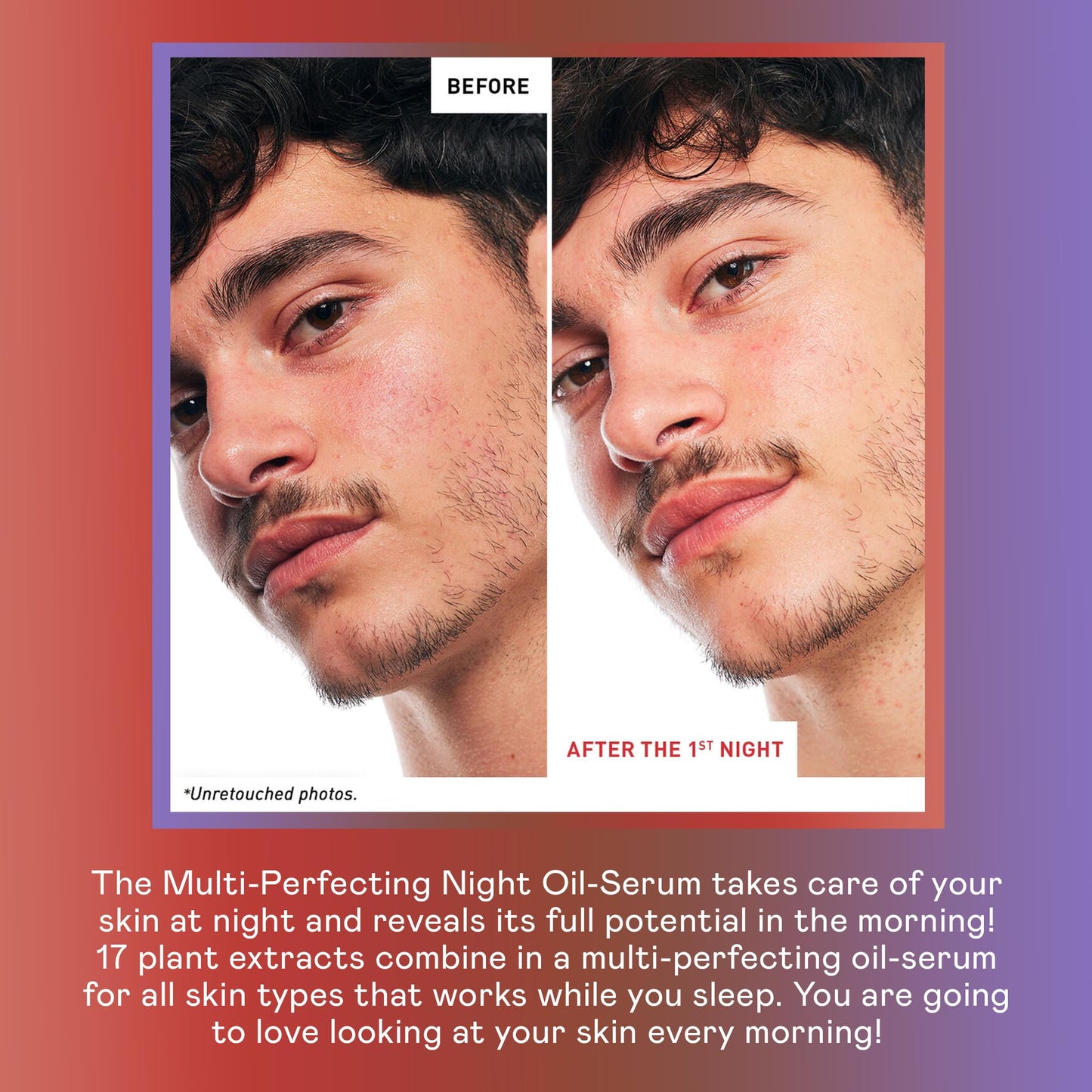 Skin Therapy Multi-Perfecting Bi-Phase Night Oil-Serum - Supercharged With 17 Ingredients -Targets 7 Skin Concerns, Improves Appearance of Fine Lines, Skin Texture, Complexion Evenness (0.33 Fl Oz)