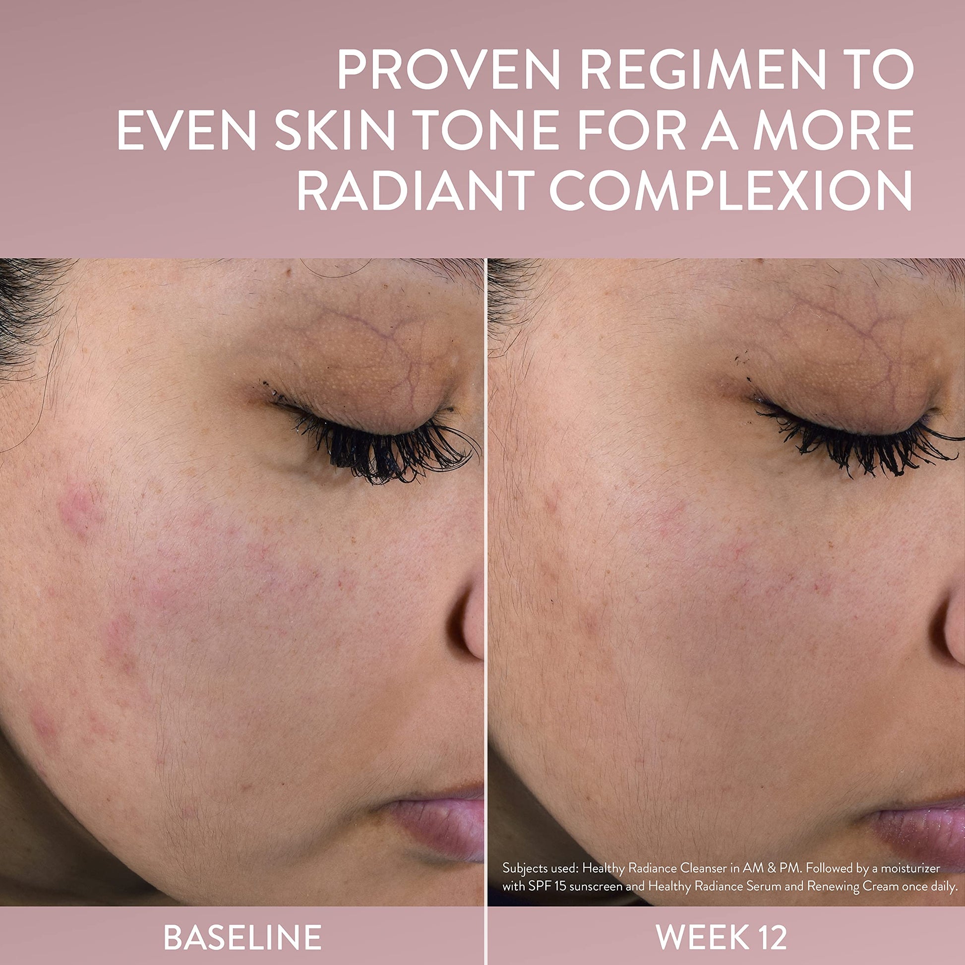 Face Serum by Cetaphil, Healthy Radiance Antioxidant-C Serum, Visibly Reduces Look of Dark Spots and Hyperpigmentation, Designed for Sensitive Skin, Hypoallergenic, Fragrance Free,1 oz