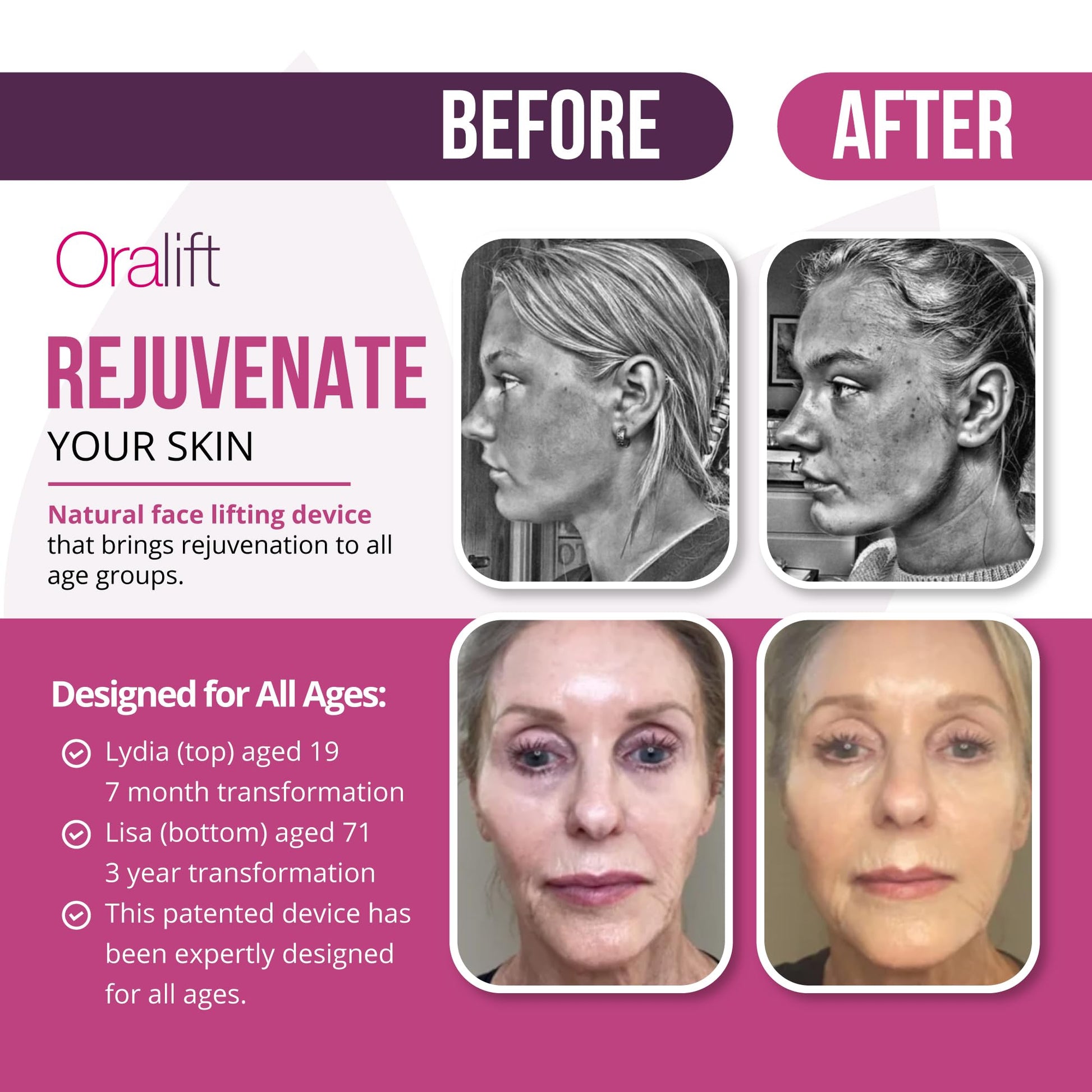 Oralift Premium: Efecto Lifting Facial Kit de Salud y Belleza Dispositivo. Apariencia Mejorada sin Ejercicio, Cirugía, Dolor, Inyecciones. Soporte por Email y Sesiones Zoom: Grupo e Individual