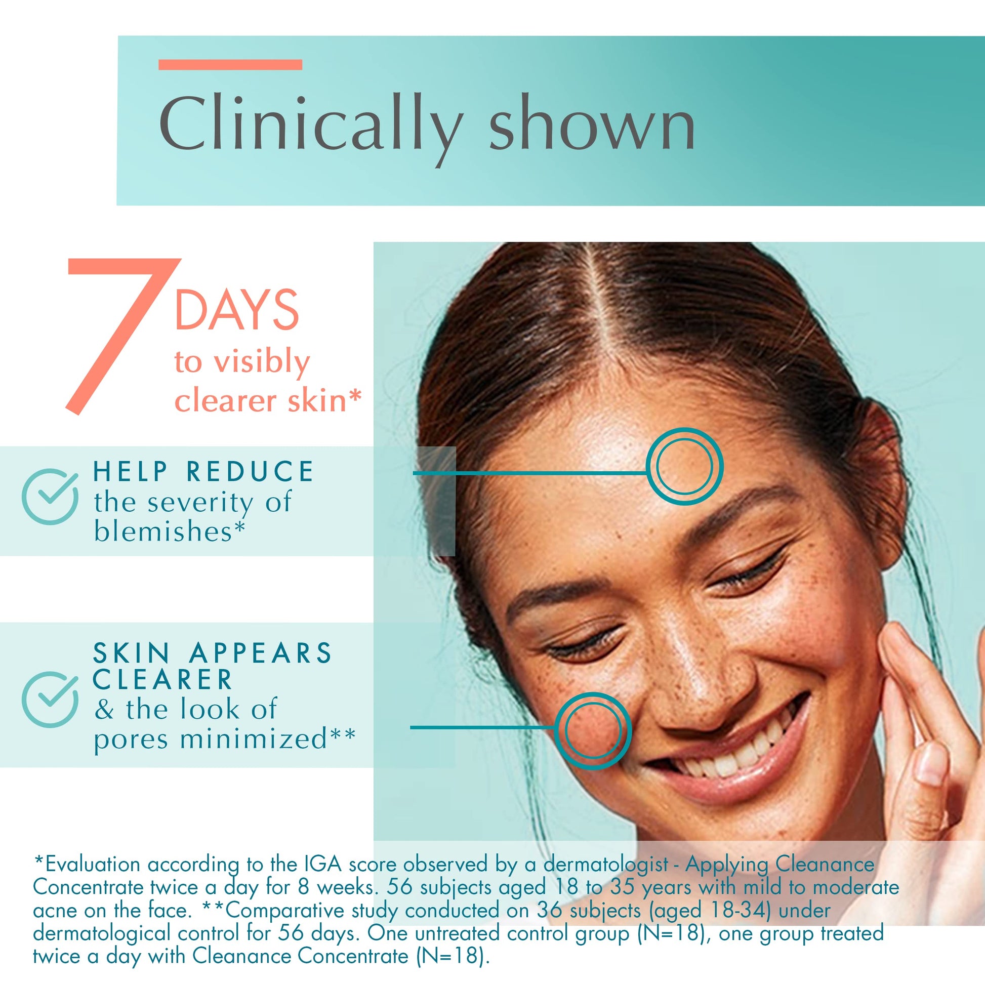 Eau Thermale Avene - Cleanance Concentrate Blemish Control Serum - Minimizes Appearance of Blemishes & Non-comedogenic - Long Lasting Results - Airless Pump, 1 fl.oz.
