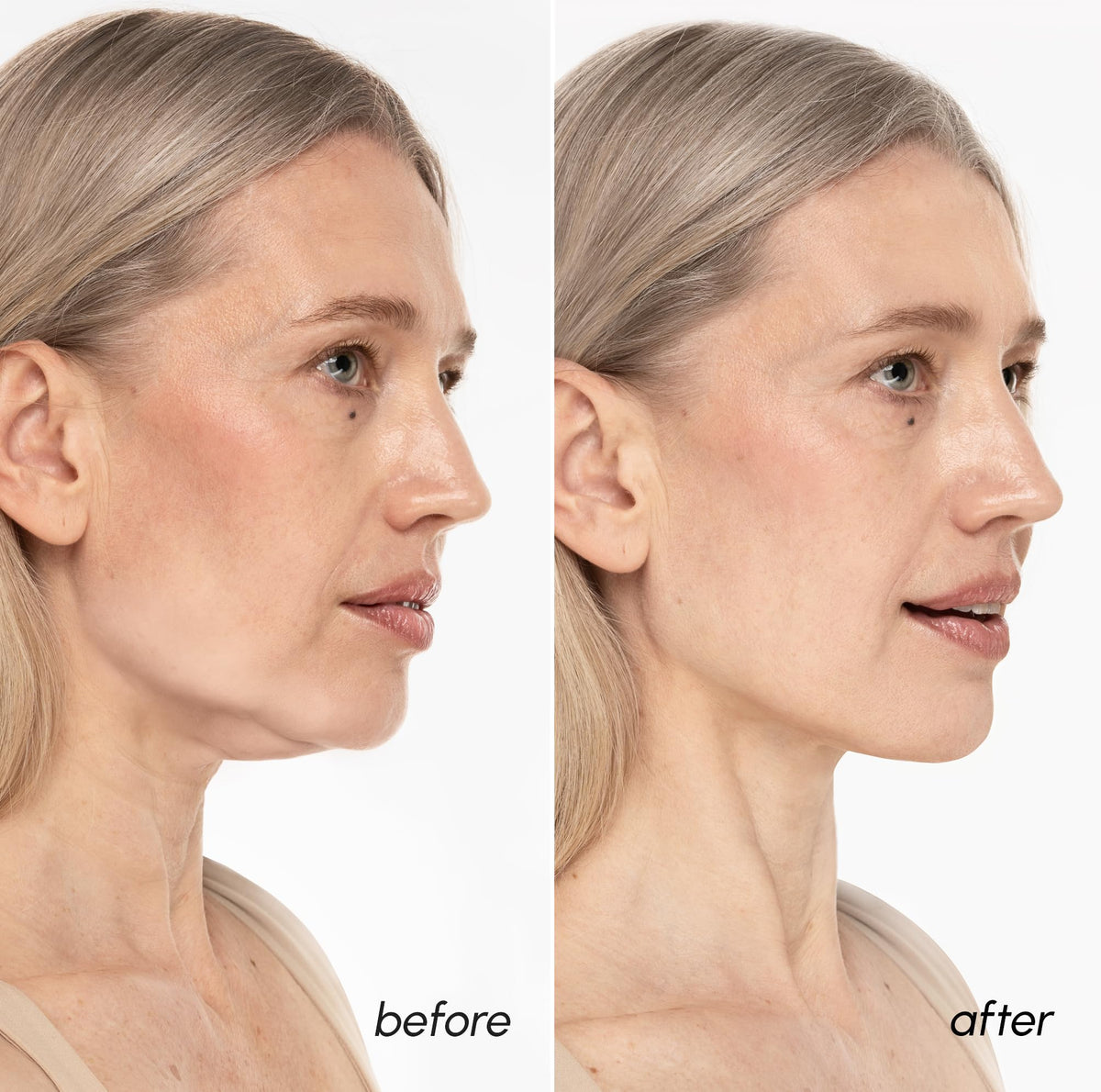 MAREE- Mascarilla reafirmante de mandíbula para mentón y cuello: la mascarilla reafirmante V Line de MAREE es perfecta para reafirmar la mandíbula. Esta mascarilla reafirmante antiarrugas de colágeno