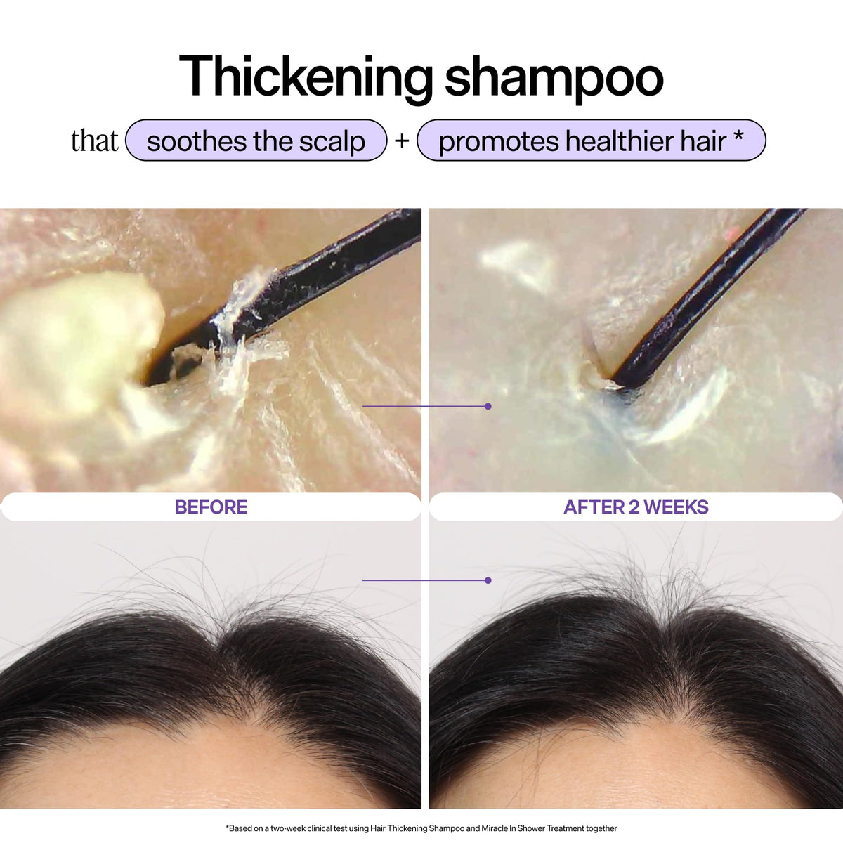 Dr. Groot Scalp Revitalizing Solution Hair Thickening Shampoo | With Biotin and Prebiotics | Clinically Proven to Help Visibly Volumize Thin, Damaged or Dry Hair | 385 ml/13 fl. oz.