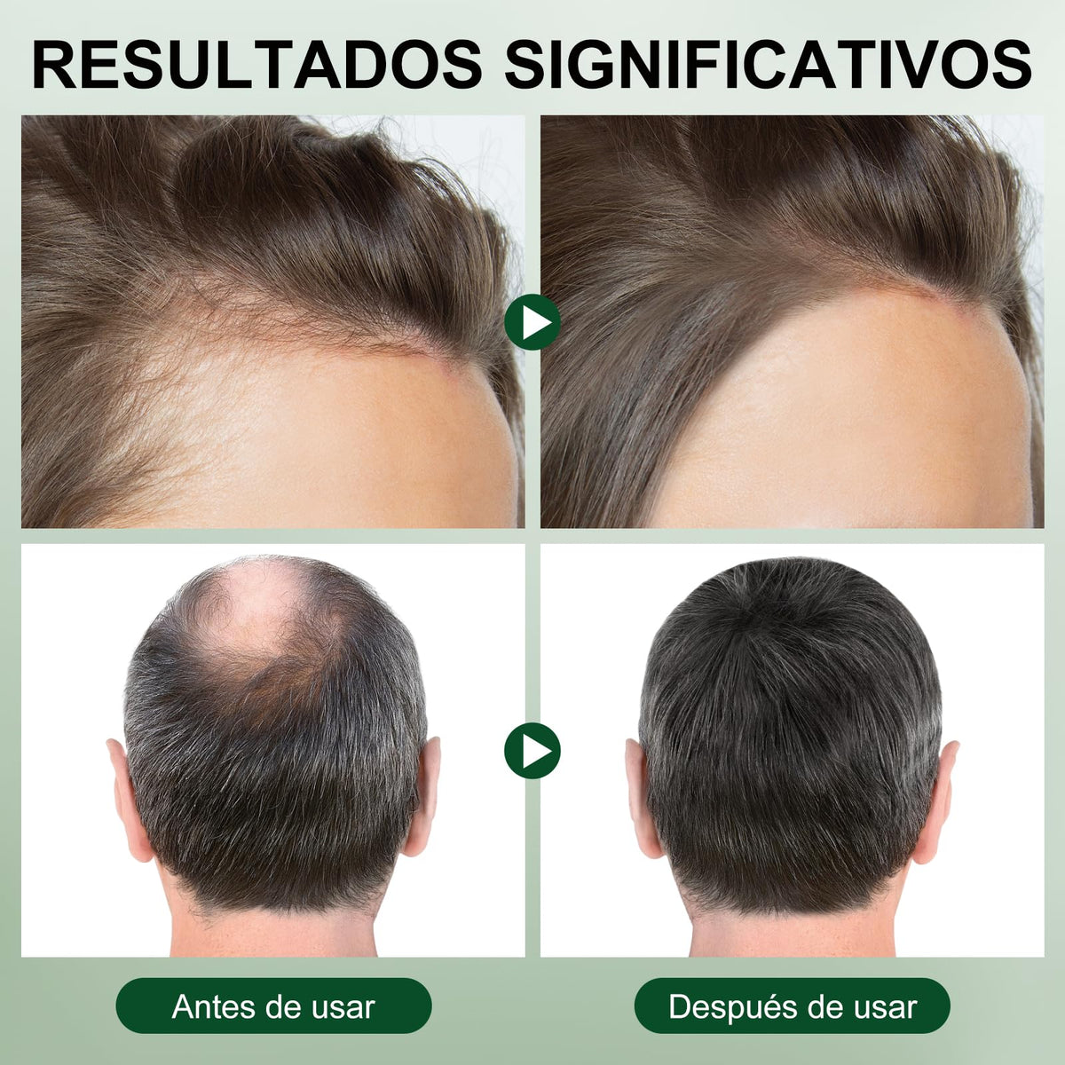 Aceite de Romero RUIAO 60ml Cuidado Capilar y Facial