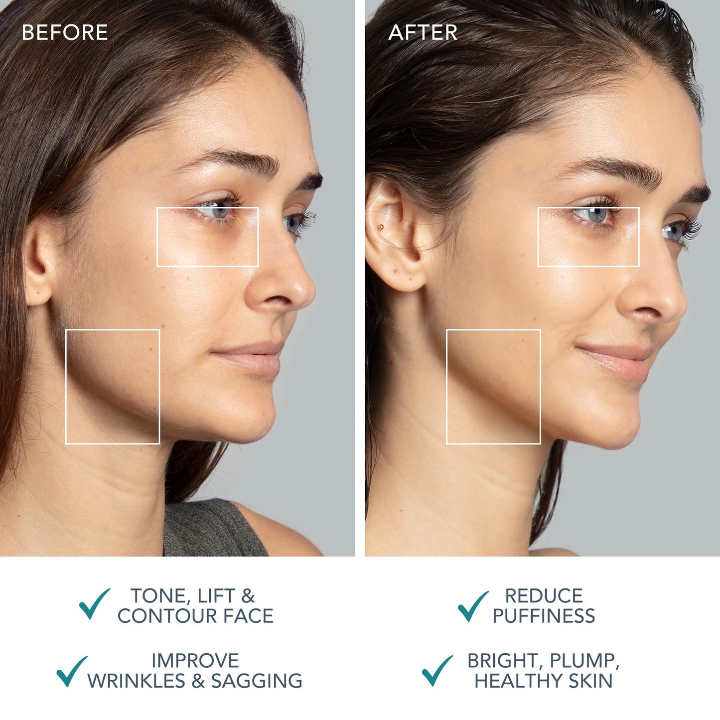 FOREO BEAR 2 - Tonificador facial de microcorrientes - Masajeador antiarrugas - Lifting facial inmediato - Reafirma y define - Mejora la absorción de las mascarillas - Evergreen