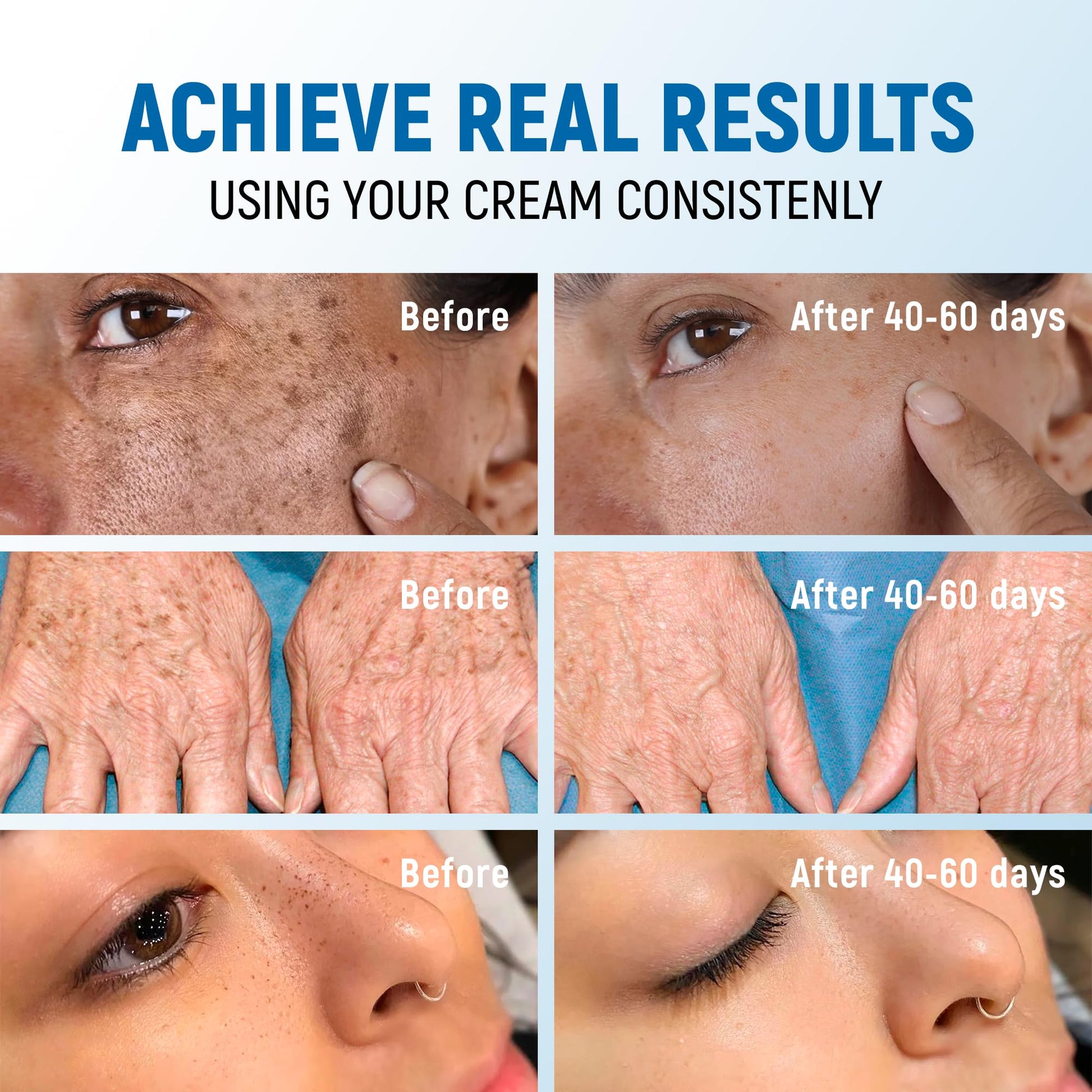 Dark Spot Remover for Face and Body - 43% Active Ingredients Blend with Vitamin C, Niacinamide, Collagen - Skin Lightening Cream for Women and Men - Dark Spot Corrector - Brightening Cream