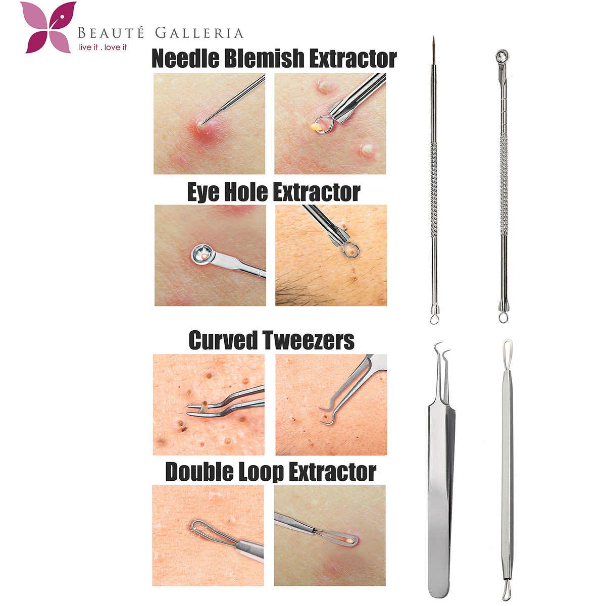 Beaute Galleria Professional Premium Blackhead & Blemish Remover Extractor Kit to cure Blackhead, Whitehead, Blemish, Comedone, Acne and Facial Impurities