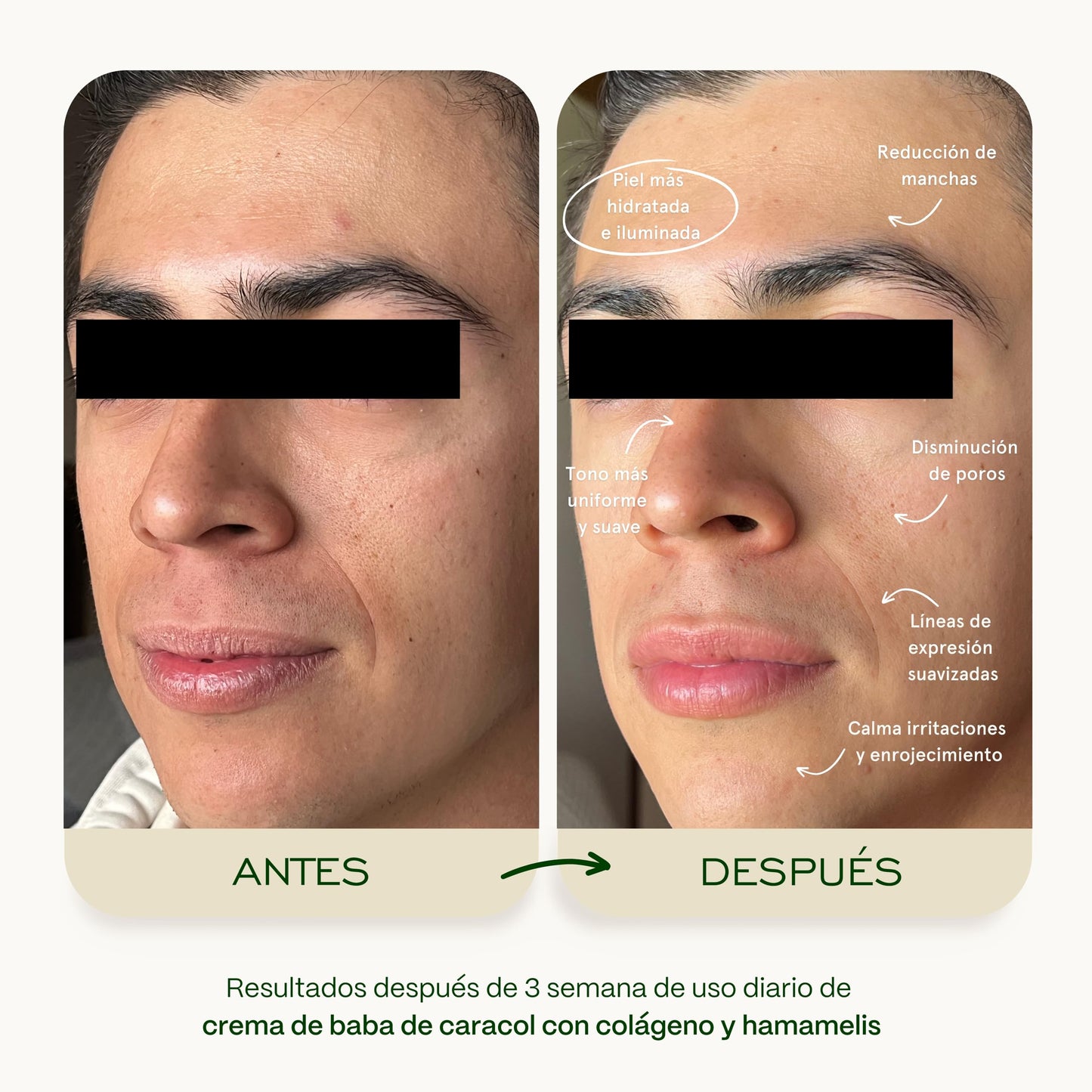 Skenties Crema Facial Baba de Caracol y Colágeno 125g - Antiarrugas, Antimanchas e Hidratante con Hamamelis - Repara y Protege FPS 25 - Skincare para Todo Tipo de Piel Mujer y Hombre