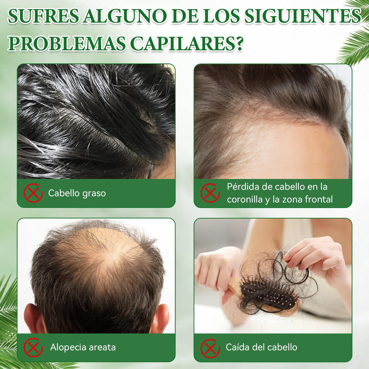 HNTCSR 2PCS Shampoo Romero,Champú de Aceite Battana de 300 ml para un Cabello Suave y con Volumen, Champú Anticaída Batana Repara el Cabello Seco y Dañado, Apto para Hombres y Mujeres