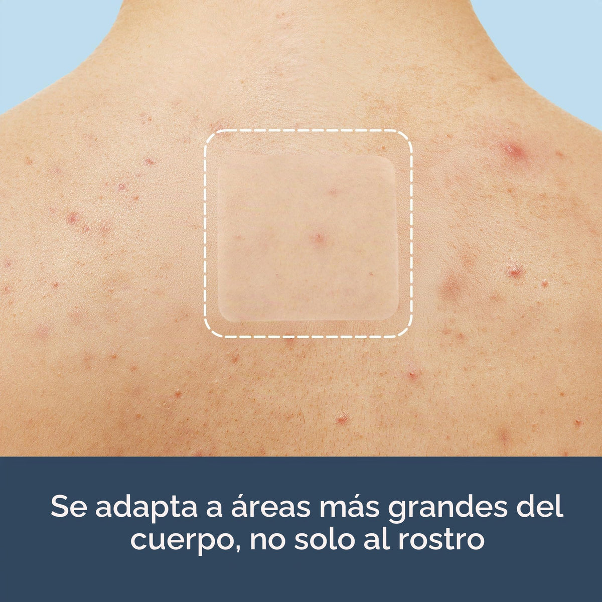 Rael Miracle XL - Cubierta de control de puntos hidrocoloides grandes