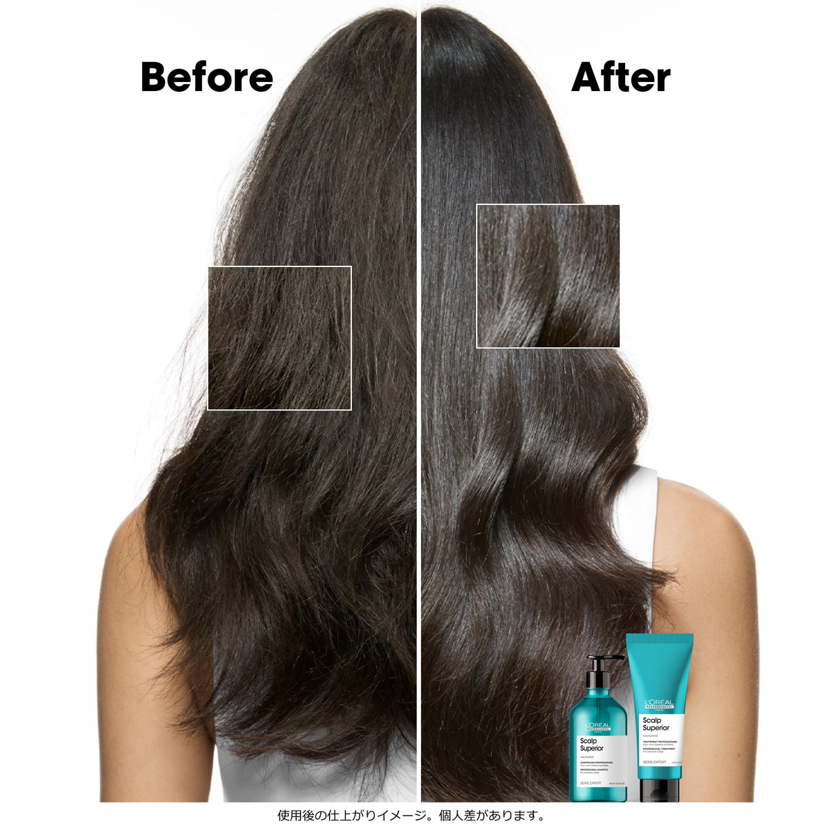 L'Oréal Professionnel |Scalp Advanced |Shampoo Sensibilidad
