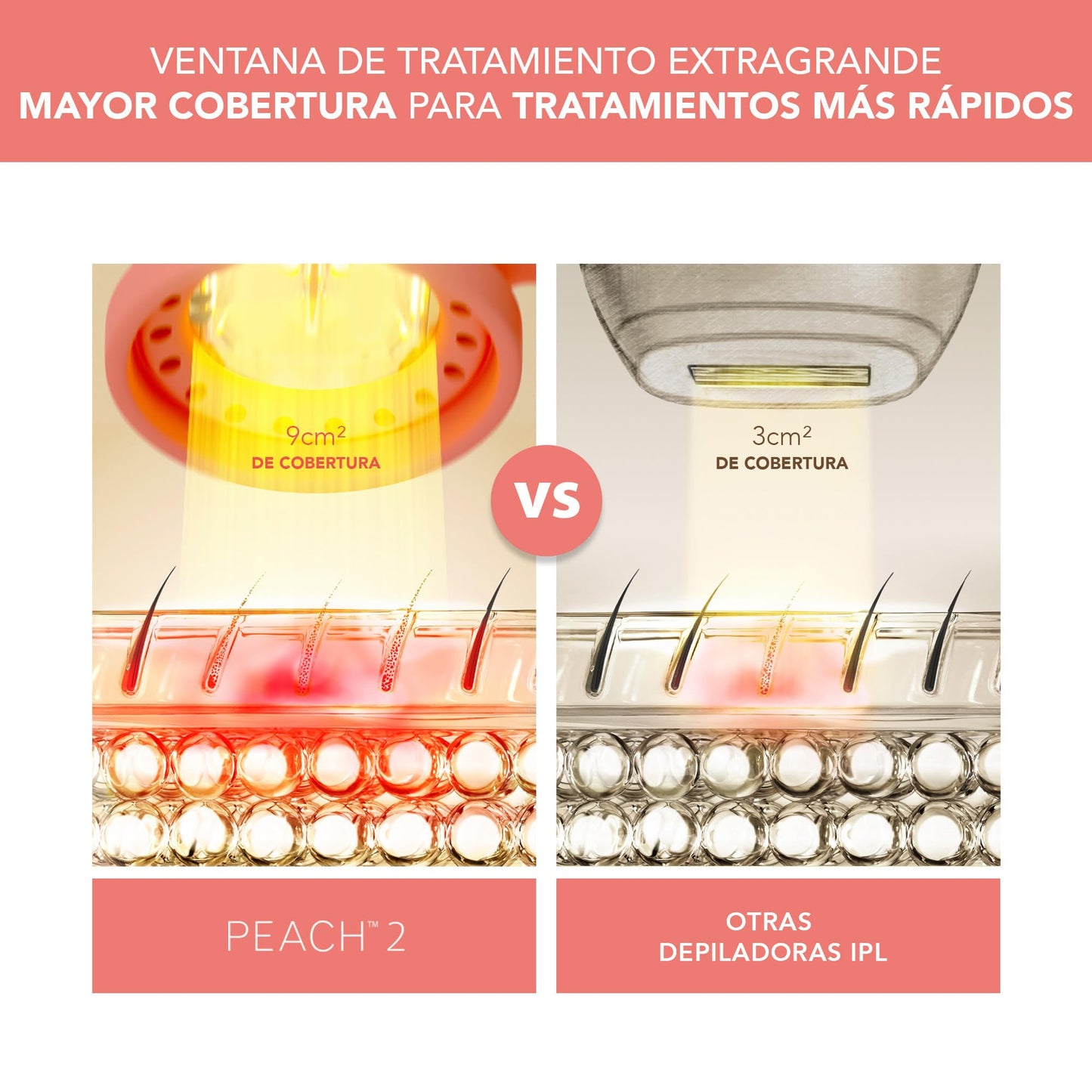 FOREO PEACH 2 – Depiladora luz pulsada IPL rostro y cuerpo – Tecnología láser depilación en casa – Incluye gel refrescante conductor preparación piel – Con enfriamiento y escudo silicona