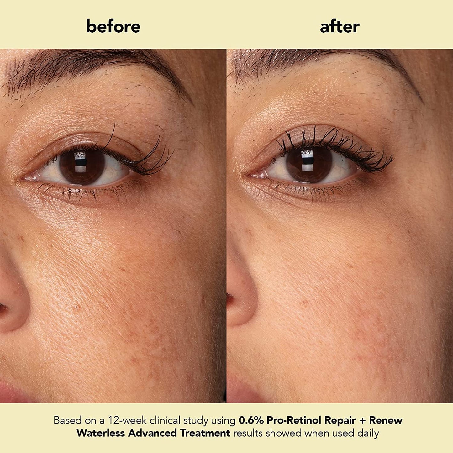 boscia Pro-Retinol Reparación + Renew Tratamiento Avanzado Sin Agua. Suero Libre de Crueldad. Anti-Arrugas, Antienvejecimiento. Vitamina C para Hiperpigmentación 1 fl oz
